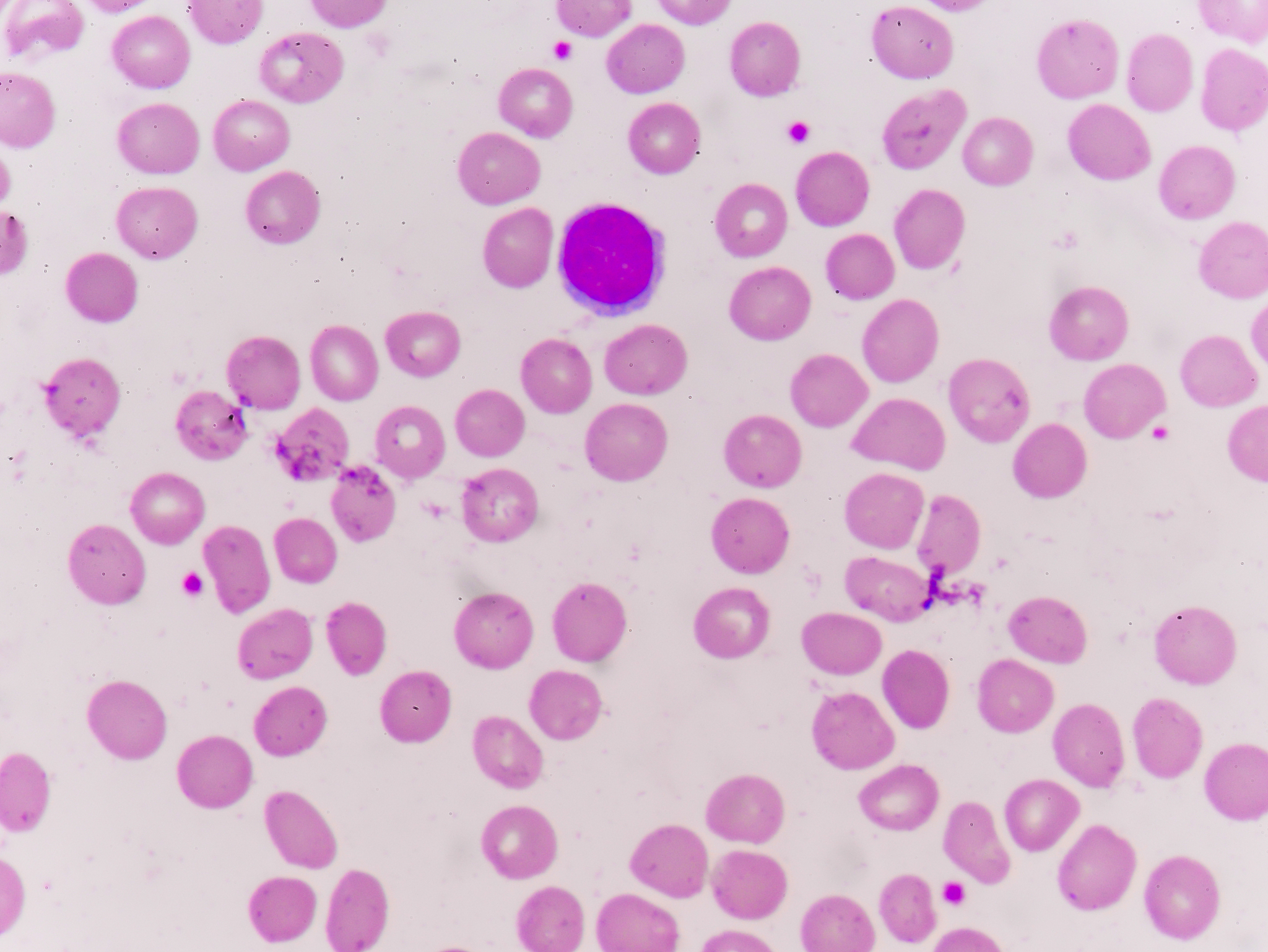 活性氧对于血管内皮有哪些影响