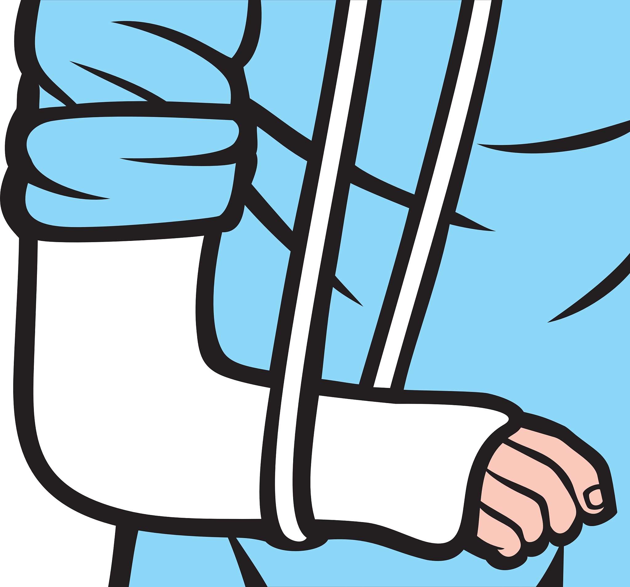 E．以上均是24．肢体长时间石膏固定最易导致的并发症是 A．关节僵硬 B．创伤性关节炎 C．缺血性肌挛缩 D．骨化性肌炎 E．骨折延迟愈合25．搬运脊柱骨折病人最正确的方法是 A．一人背起病人搬运 B．三人同时平托病人搬运 C．一人抬头一人抬腿搬运D．一人抱起病人搬运 E．一人滚动病人搬运26．最容易发生脱位的关节是 A．肩关节 B．肘关节 C．髋关节 D．膝关节 E．踝关节27．化脓性关节最常见