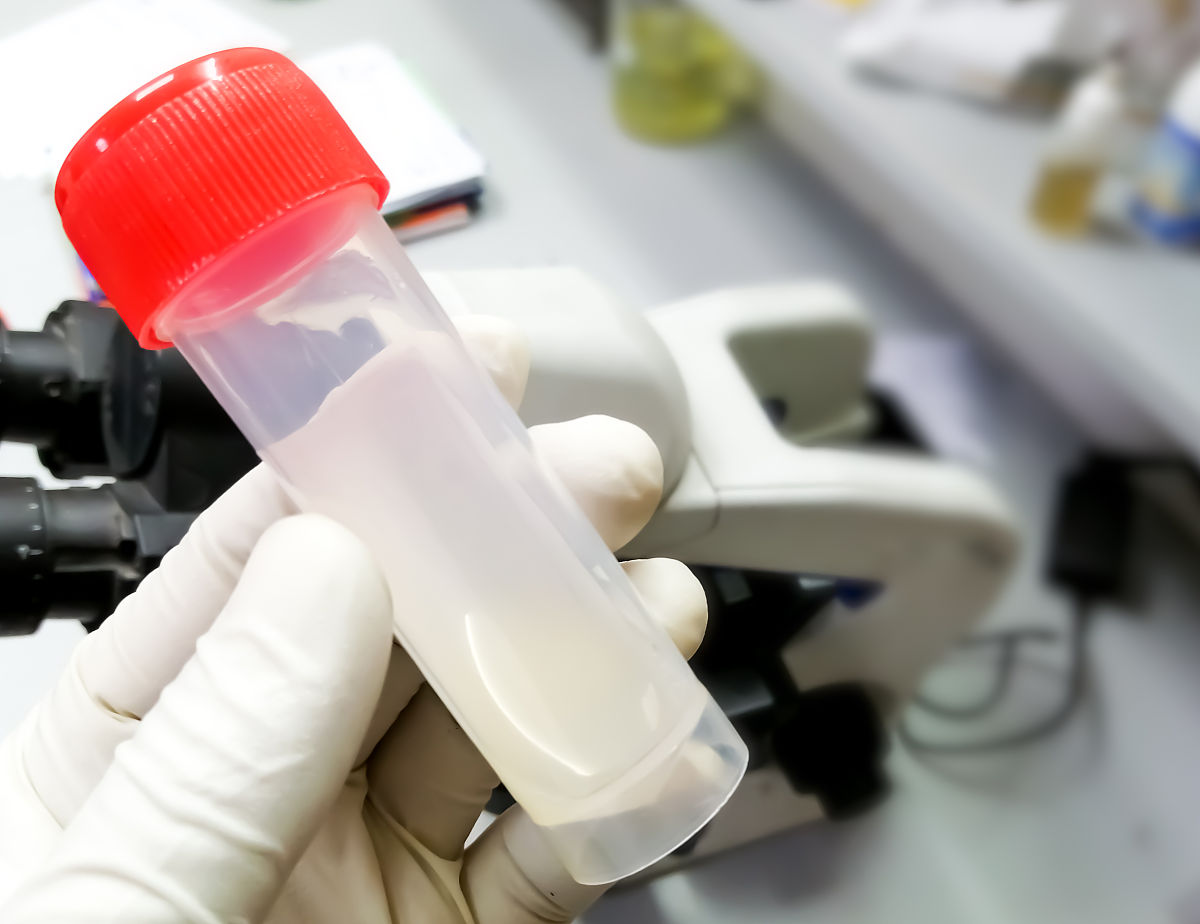 流式细胞术在精子学中的应用与发展