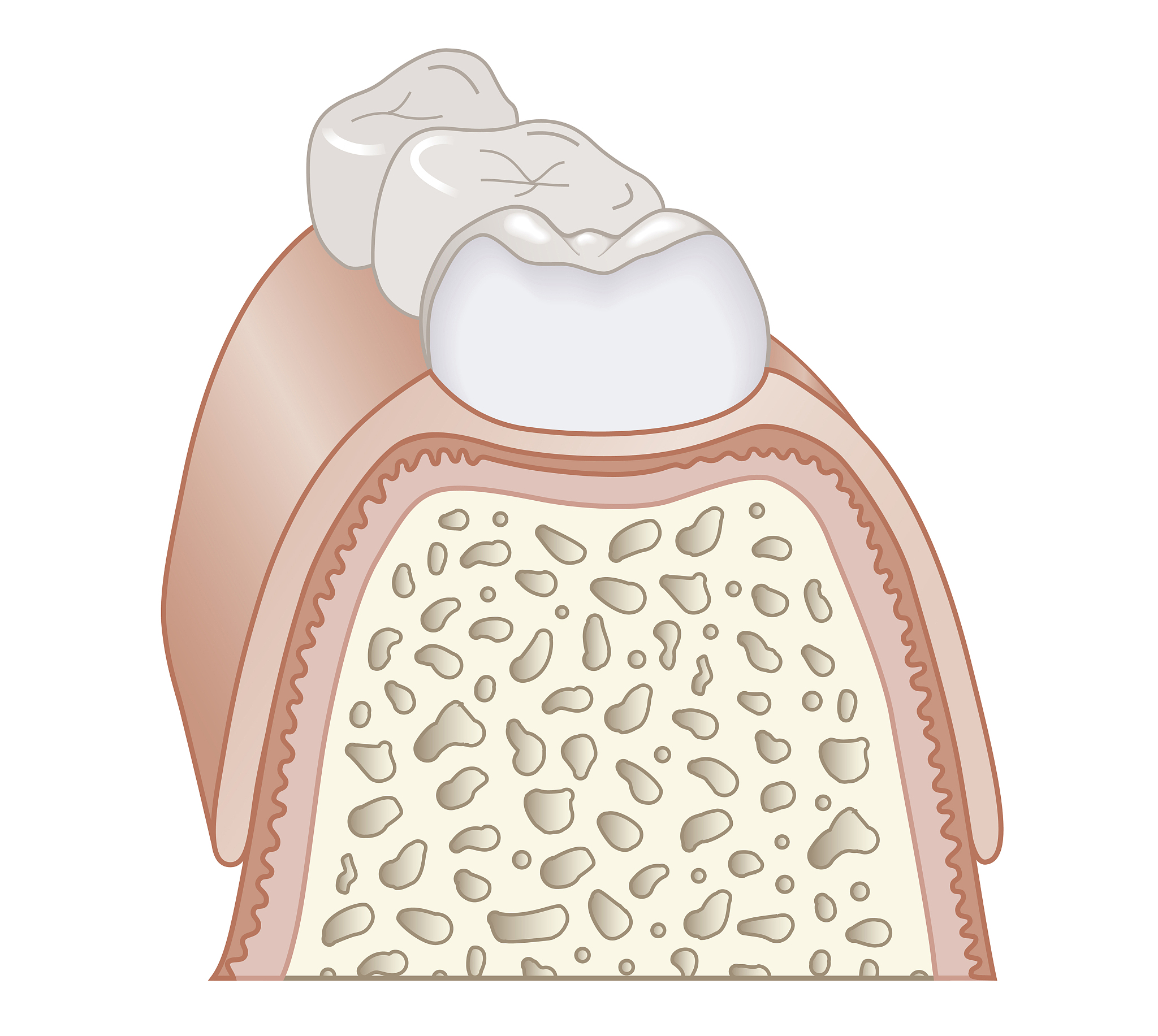 可以翻译The purpose of the present paper is to report a case in which there was osseous repair of an experimentally induced periodontai pocket without new attachment of connective tissue fibers to the roo