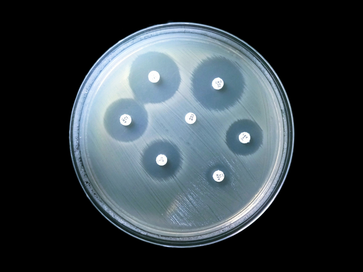 含有百分之2的琼脂培养基湿度大概是多少