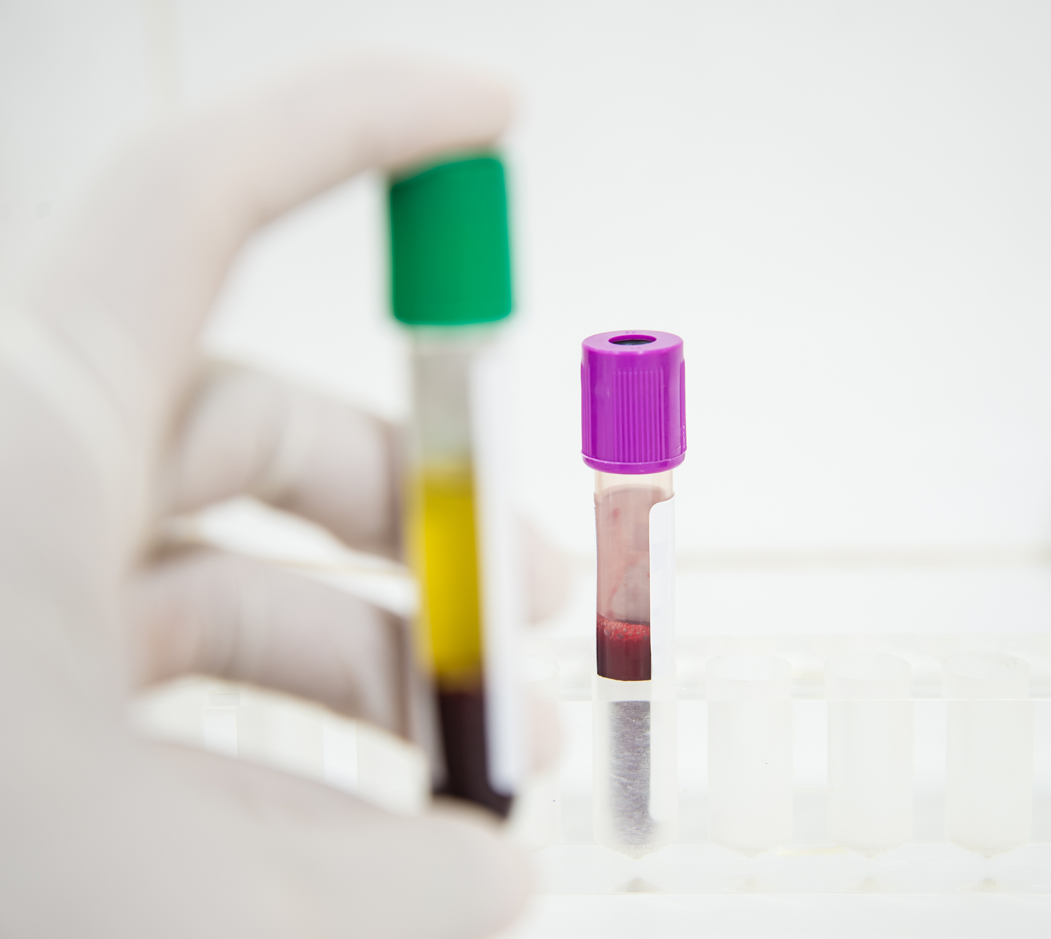 离心血清和血浆: 最佳转速和温度指南