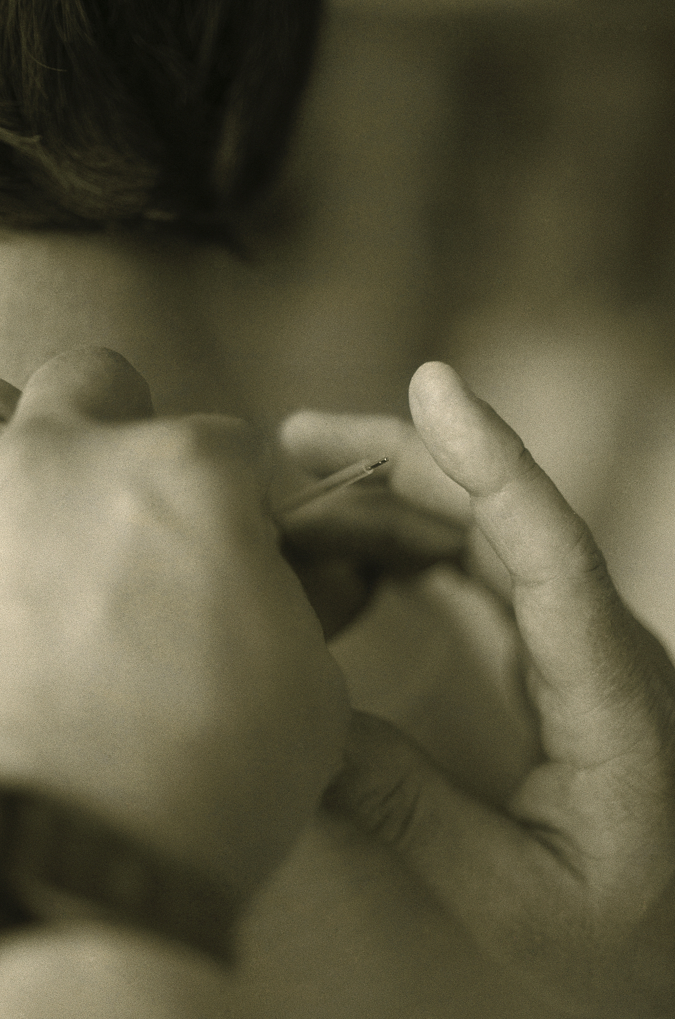 person receiving acupuncture treatment