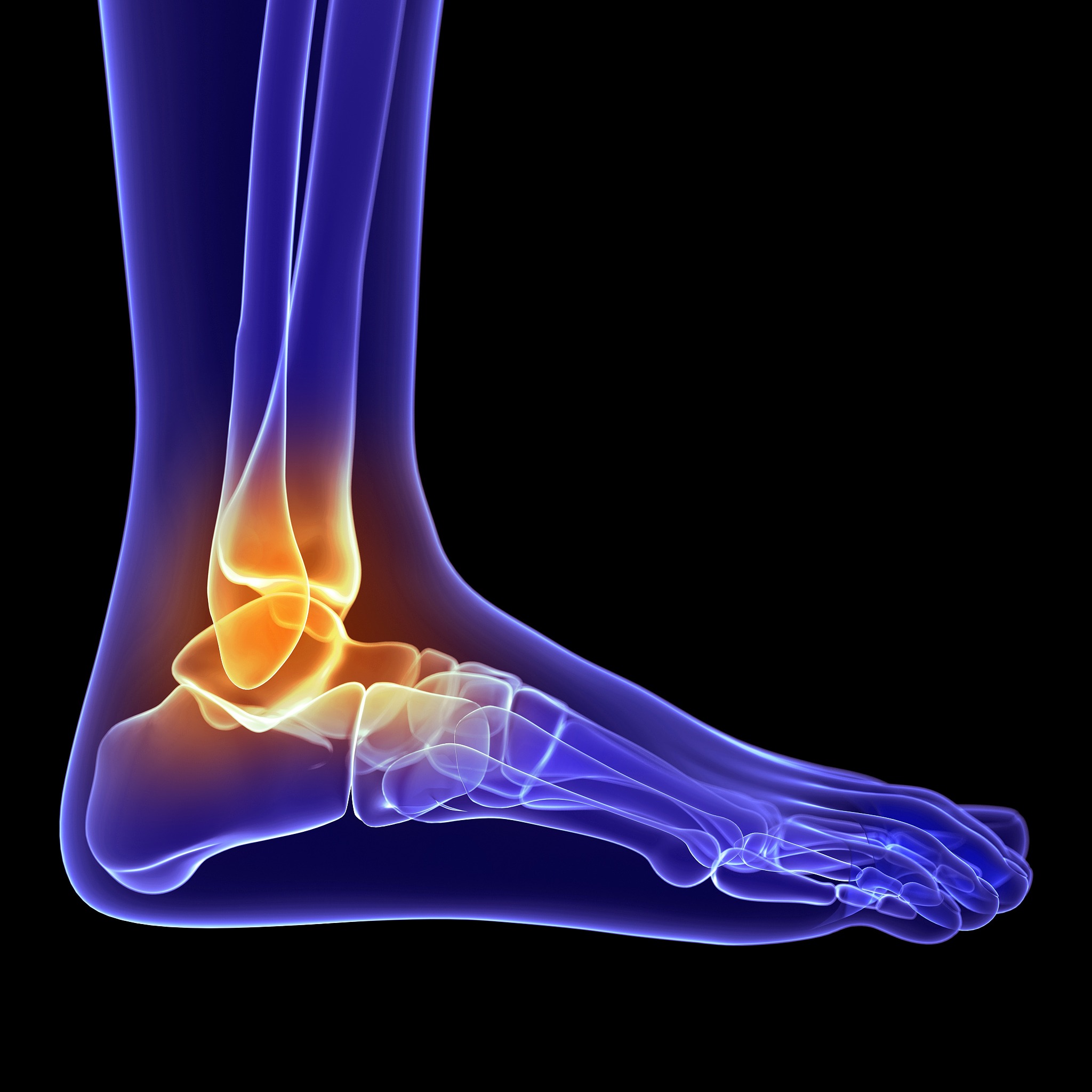 脚扭了：疼痛类型及原因 | 损伤后的恢复指南