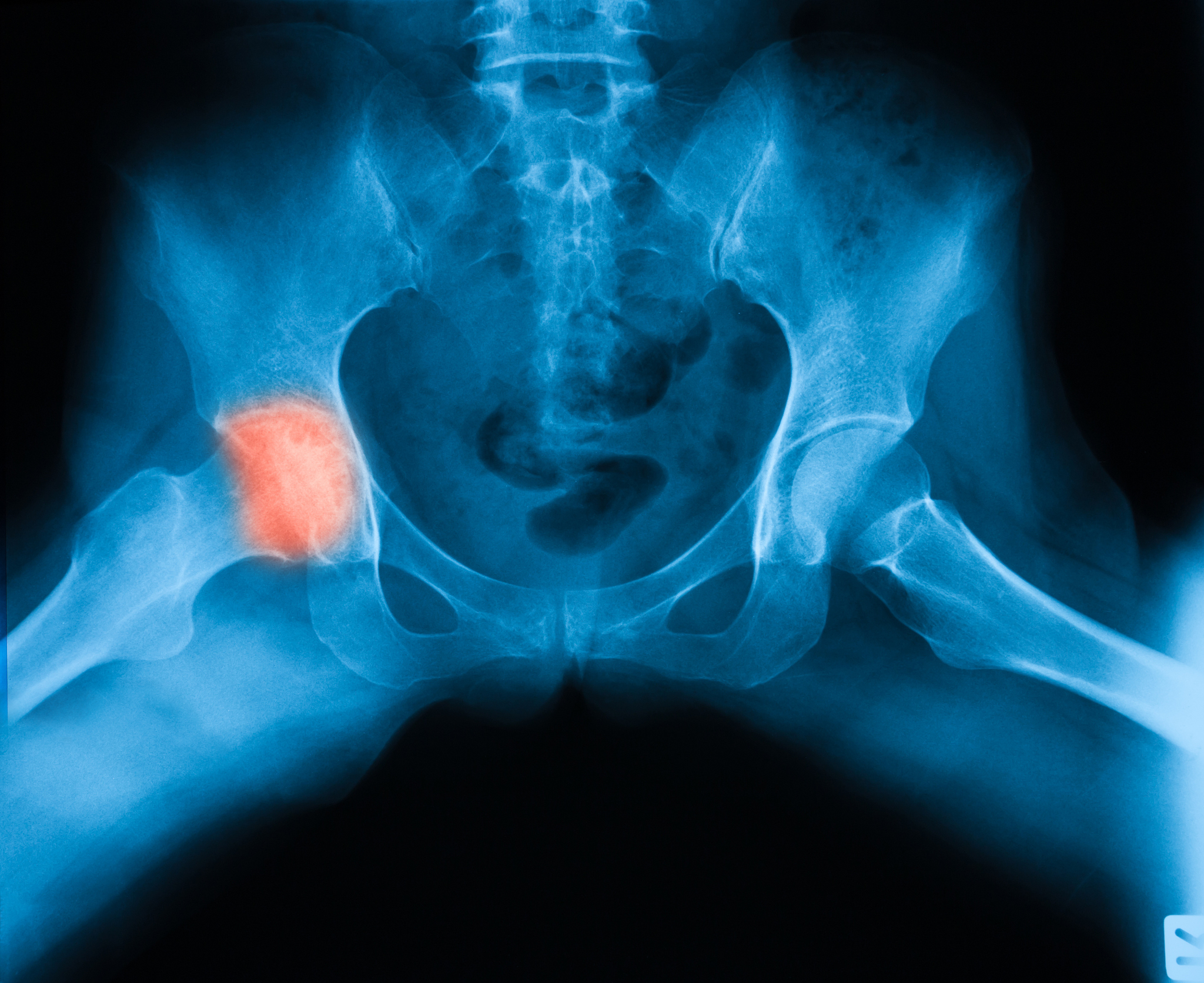 压青蛙腿的功效与注意事项 - 传统疗法解析