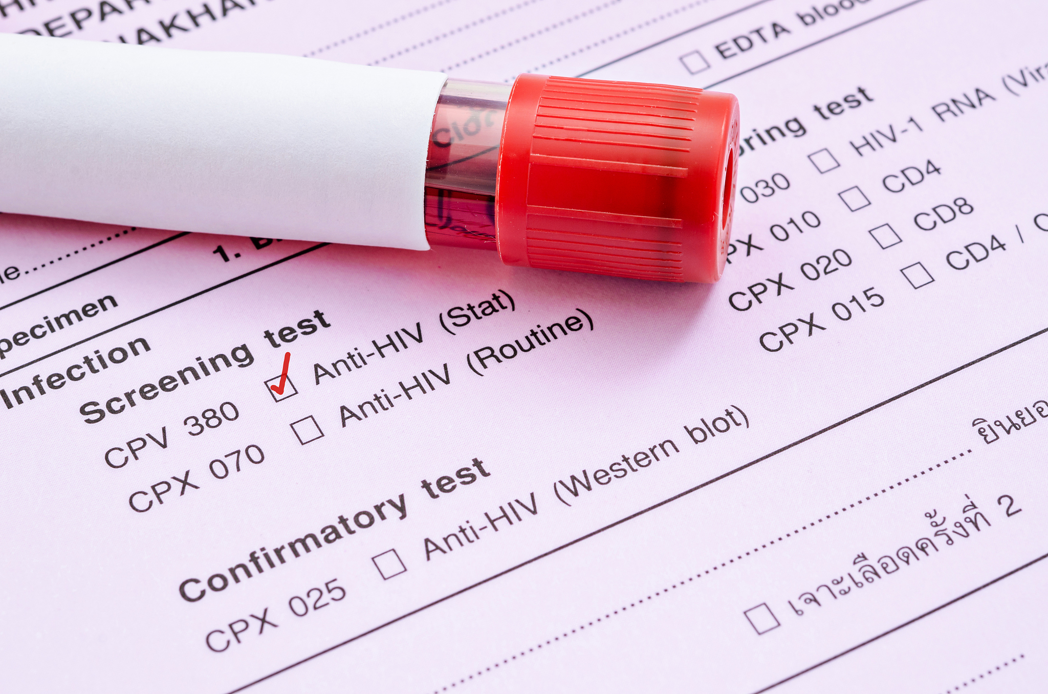 医院HIV检测结果显示含量非0，意味着什么？