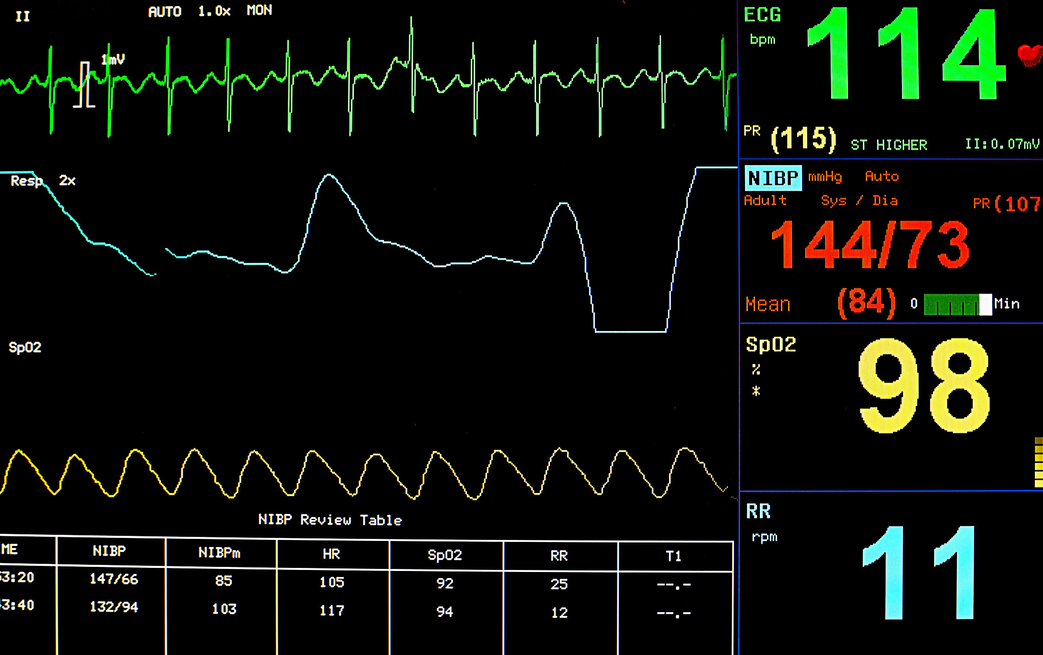 心率监测系统的相关理论