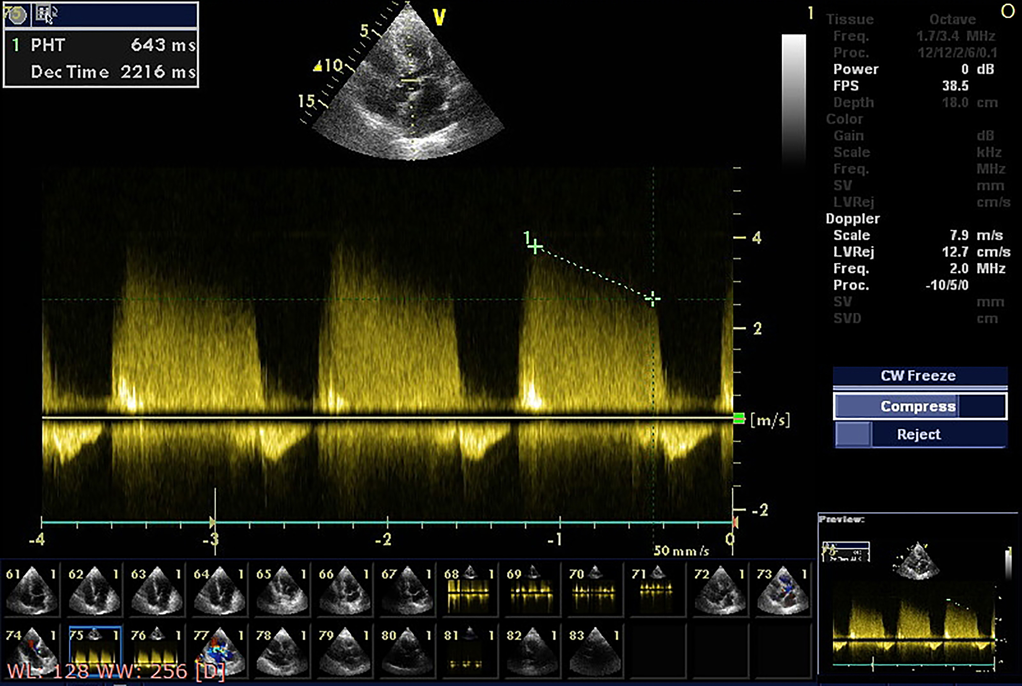 齿轮箱的振动信号非常复杂不仅反映了齿轮和轴承本身的工作情况而且包含了大量其他机械运动部件和结构的信息。如果仅仅从时域、频域或快速傅里叶变换的角度分析齿轮箱的振动信号要准确诊断齿轮箱的各种故障是非常困难的。句子改写