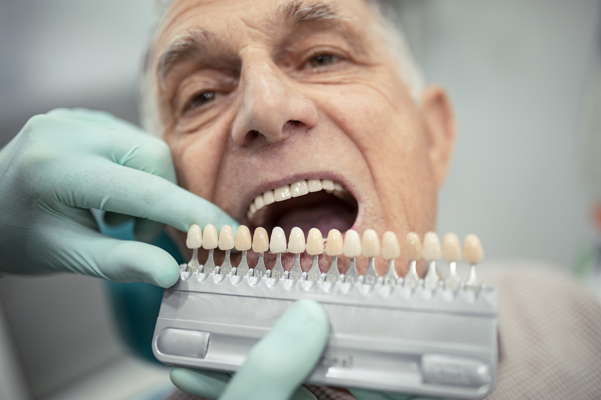 老年人适合种植牙么？