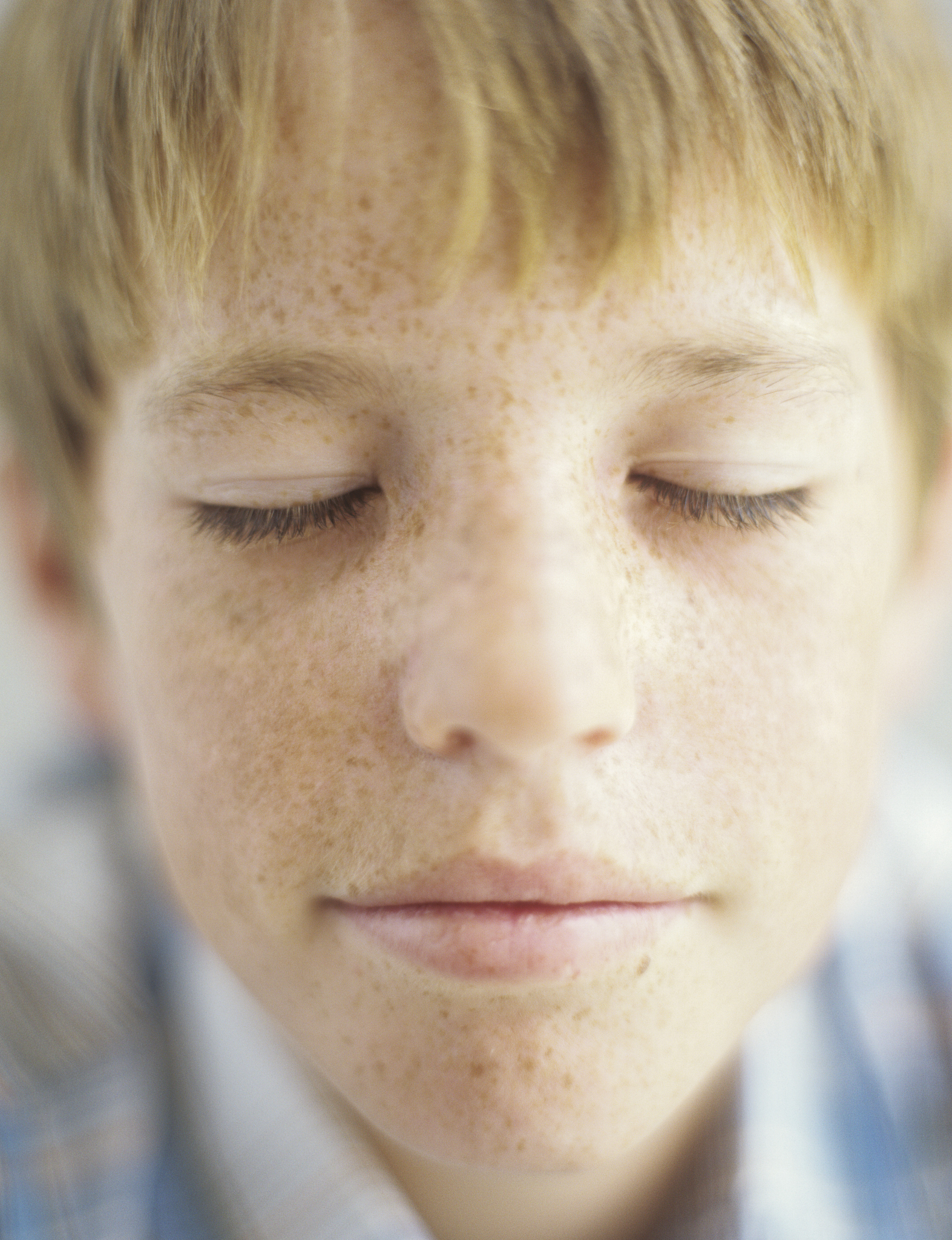 雀斑是怎么来的