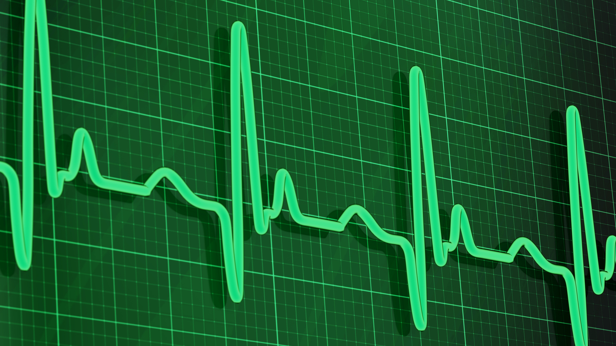 心率变异60ms以上，可能存在哪些问题？