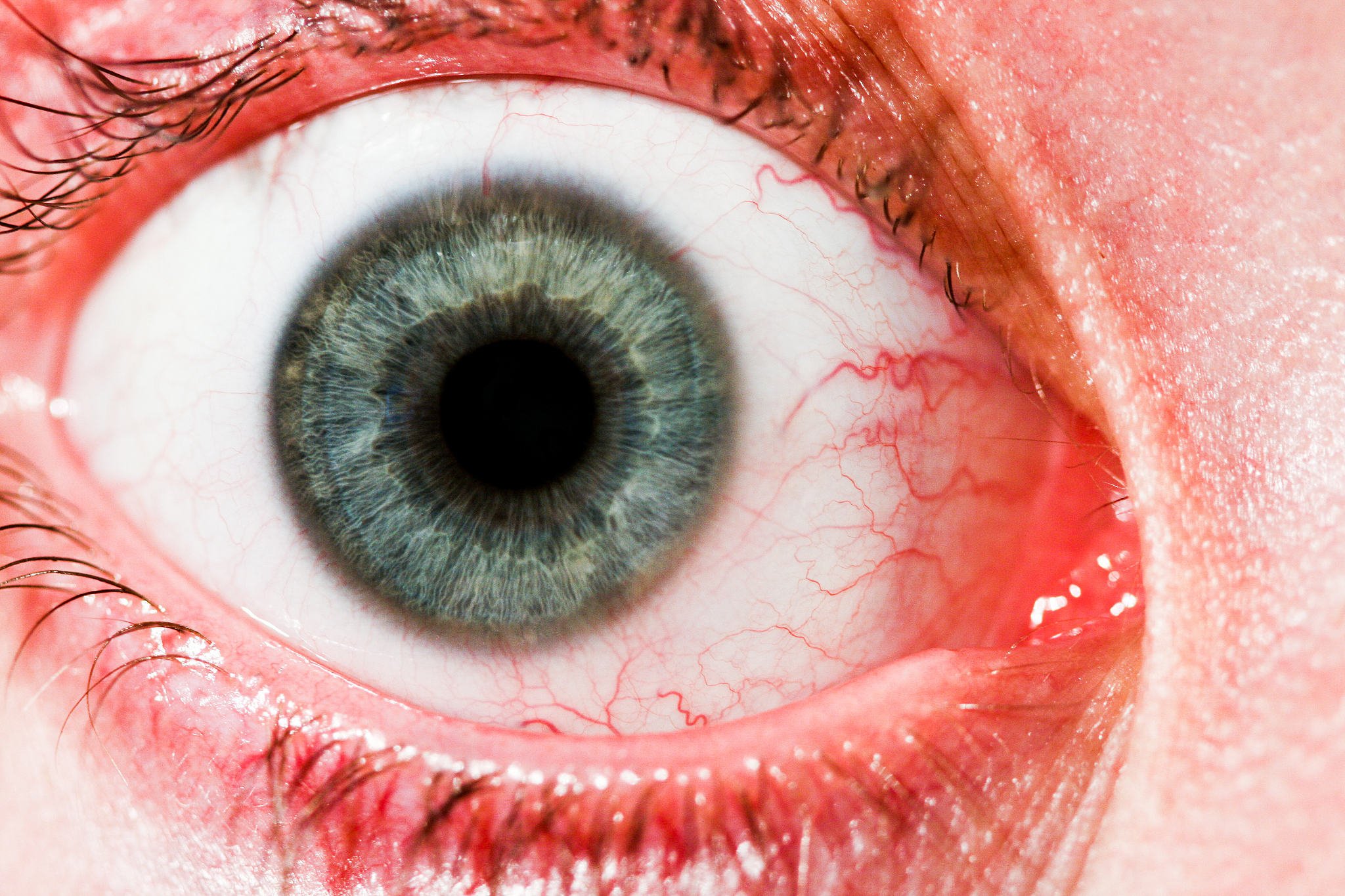 red eye