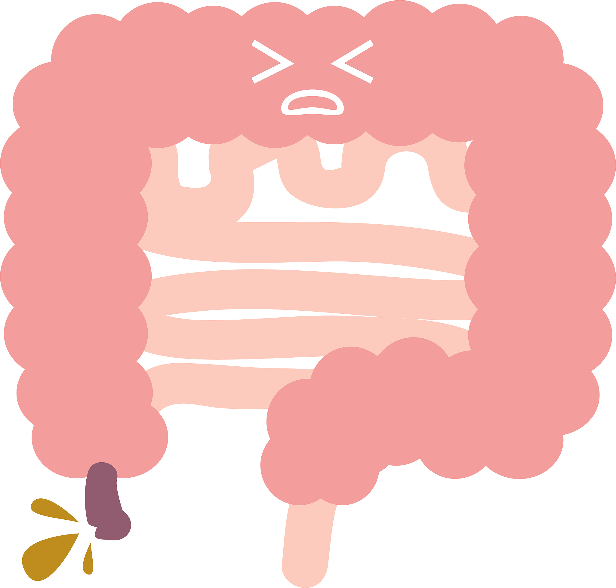 阑尾炎微创后多久上班