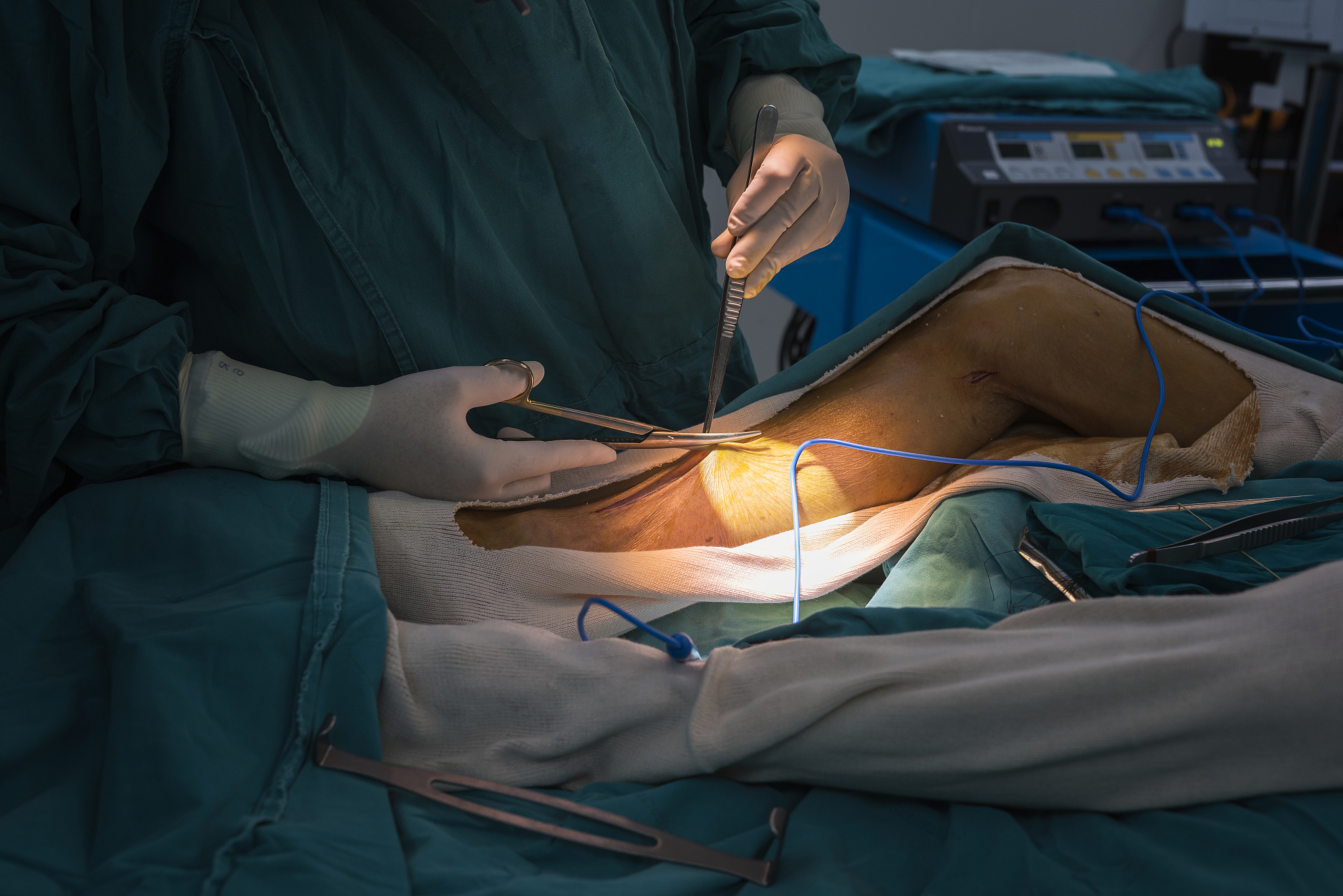greater saphenous vein harvest for venous conduit