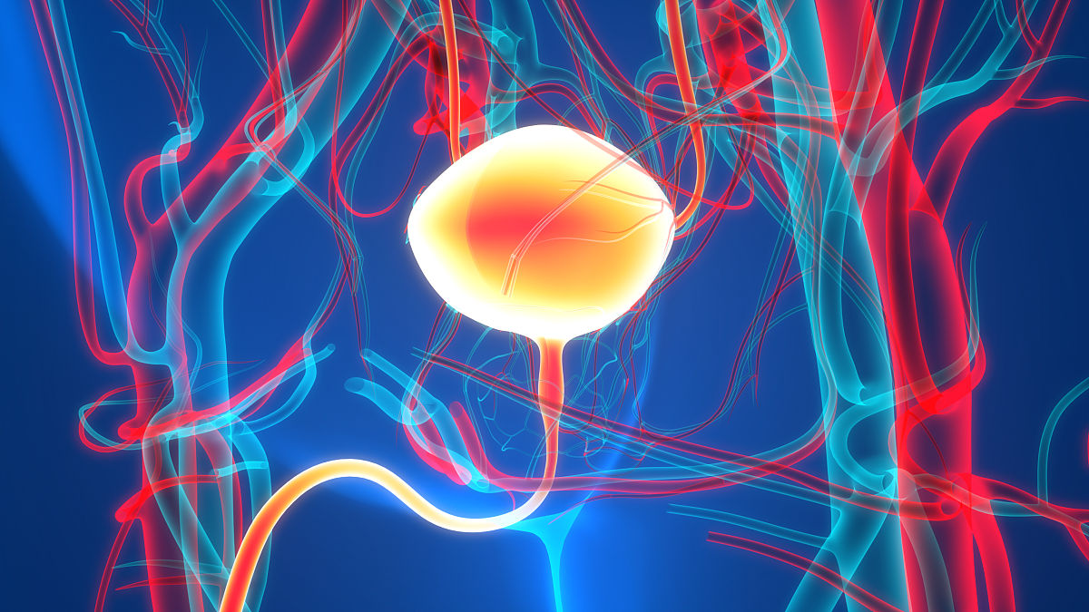请改写下面一段话：1TURP术后出现UI的主要原因有以下几种：1术中前列腺远端电切过多伤及外括约肌术后前列腺窝内气囊压力过大长期压迫造成永久性外括约肌收缩乏力而导致真性尿失禁。2感染：前列腺或膀胱感染时病人尿意急迫出现类似尿失禁的表现。3梗阻：前列腺组织的残留膀胱颈纤维化或尿道狭窄导致下尿路梗阻21它们均可致残余尿量增多或有明显尿潴留此时病人表现为充盈性尿失禁。4膀胱功能障碍：当前列腺增生症的病人
