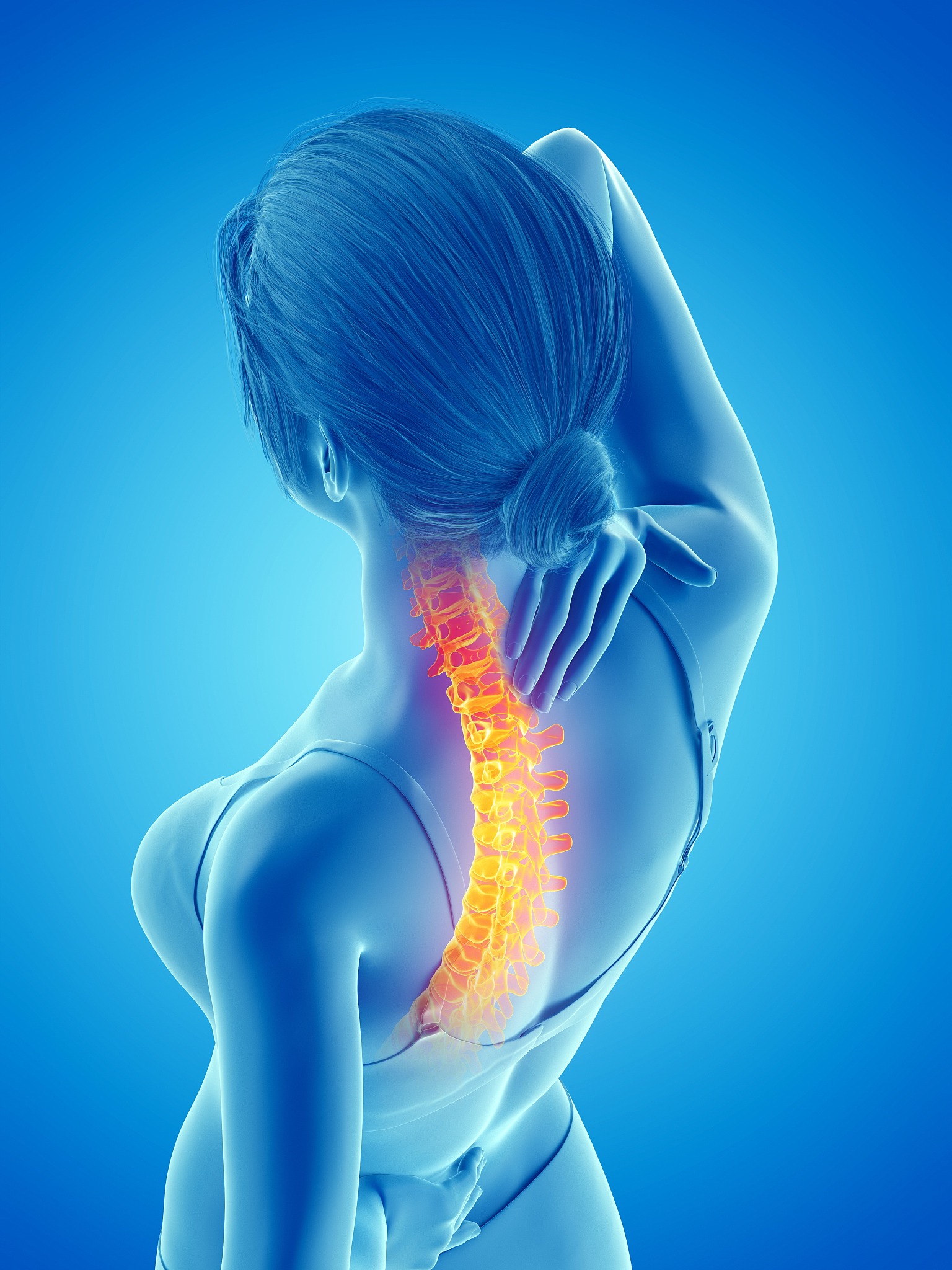 woman with a painful back, illustration