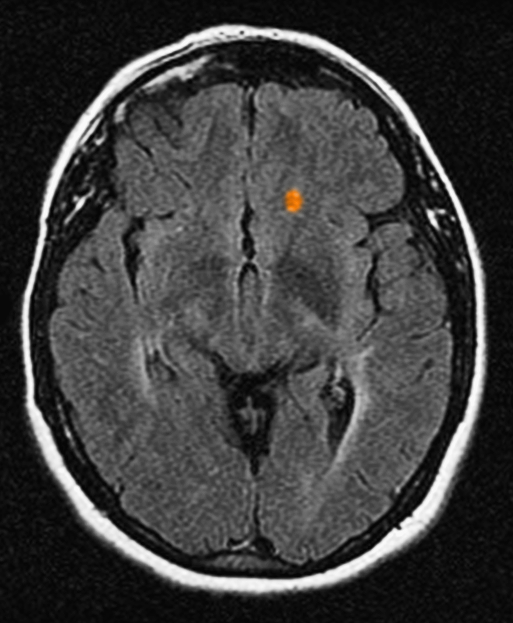 难以治愈的疾病：现状、治疗与应对