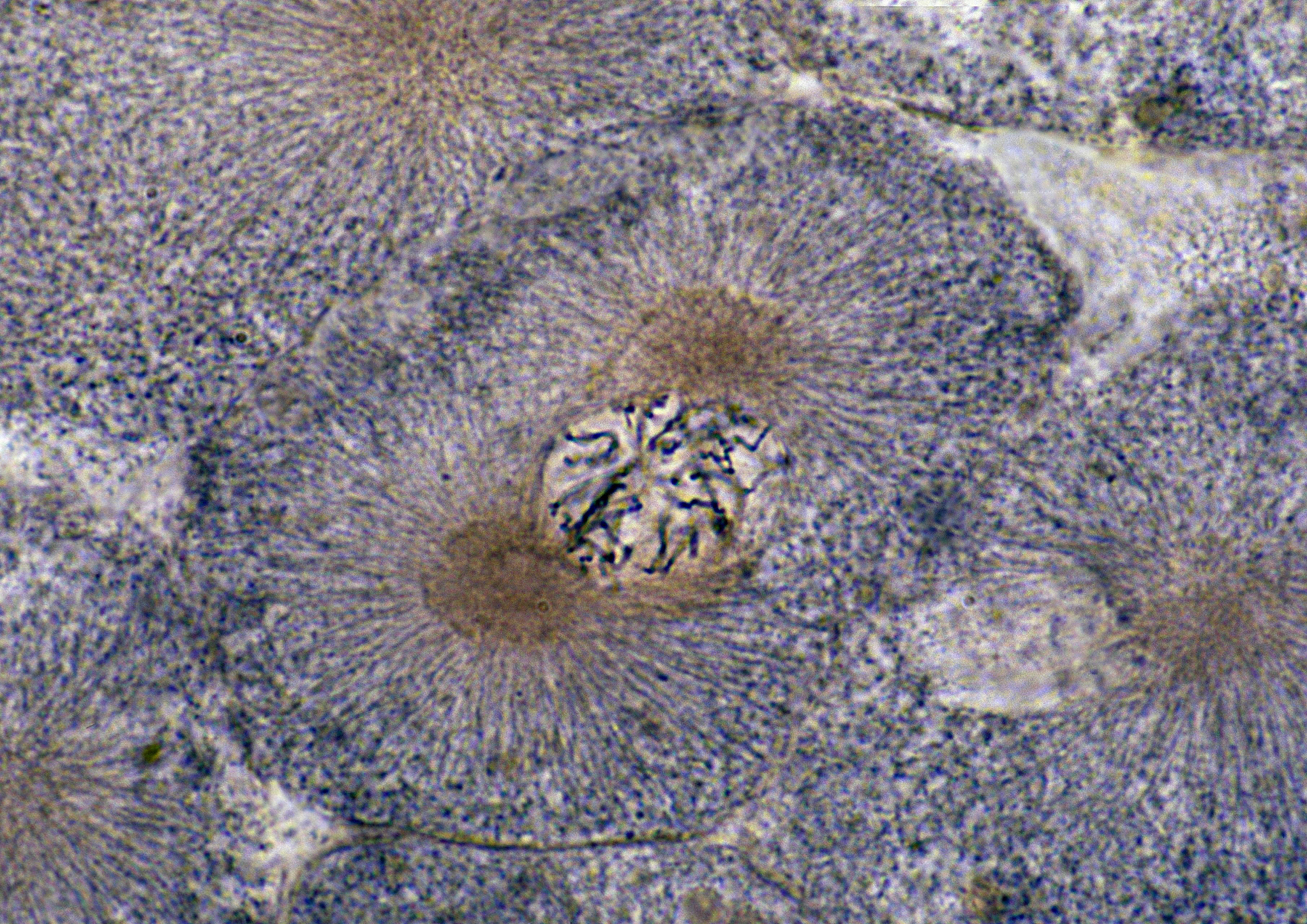 小鼠骨髓染色体G显带实验：低倍镜下观察不到分散分裂相的原因及解决方法