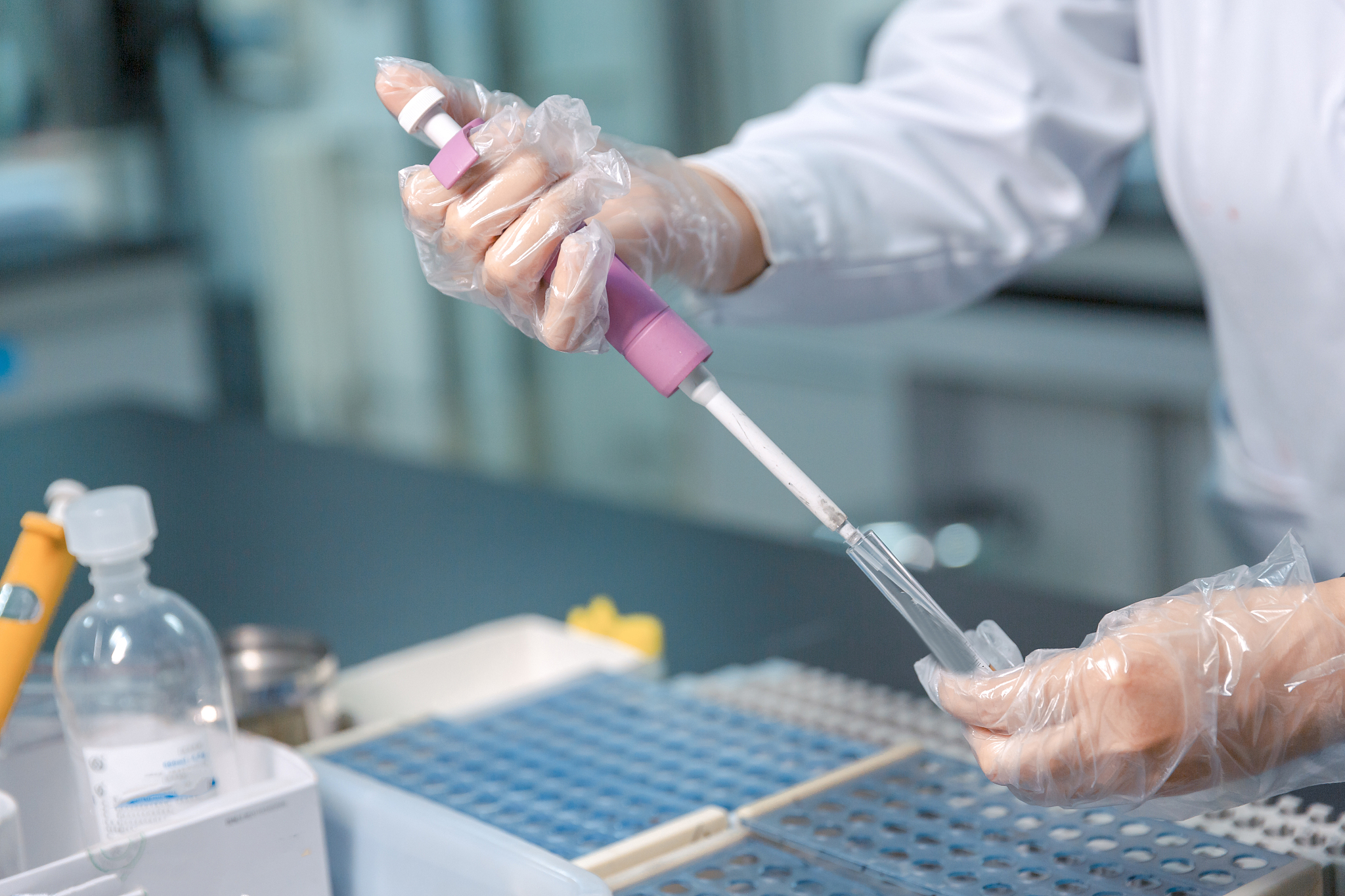 HIV患者可以做试管婴儿吗？