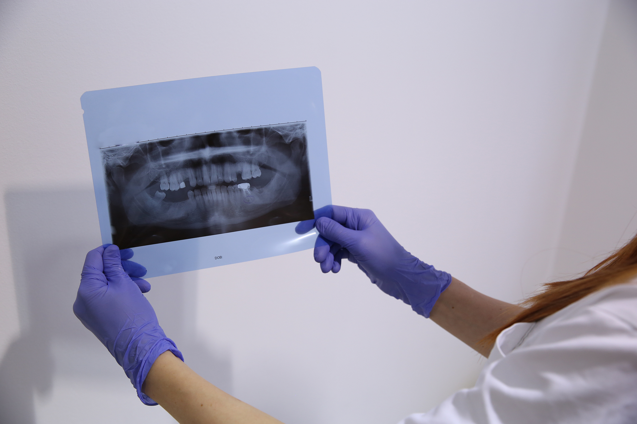 贵阳市卫生学校口腔医学专业就业方向：未来发展趋势及所需技能