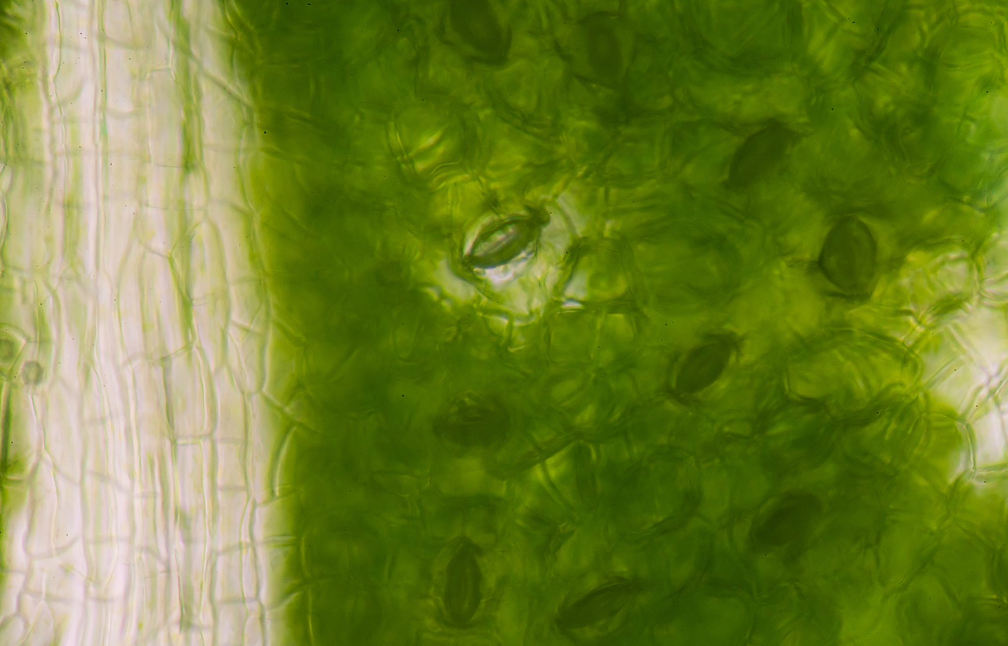 请将这些关键点扩写成文字1 磺胺甲噁唑是一种磺胺类抗生素可竞争性抑制细菌的二氢叶酸合成酶来达到抑菌杀菌的目的。2 磺胺甲噁唑对革兰氏阳性菌和革兰氏阴性菌均具有抗菌活性但目前细菌对该类药物的耐药性普遍存在。3 研究显示磺胺甲噁唑可以通过破坏微囊藻细胞膜的完整性抑制藻细胞的生长。4 磺胺甲噁唑在高浓度下50μgL和125μgL促进了藻细胞叶绿素a荧光强度的提高同时导致藻细胞膜超极化。5 磺胺甲噁唑促进