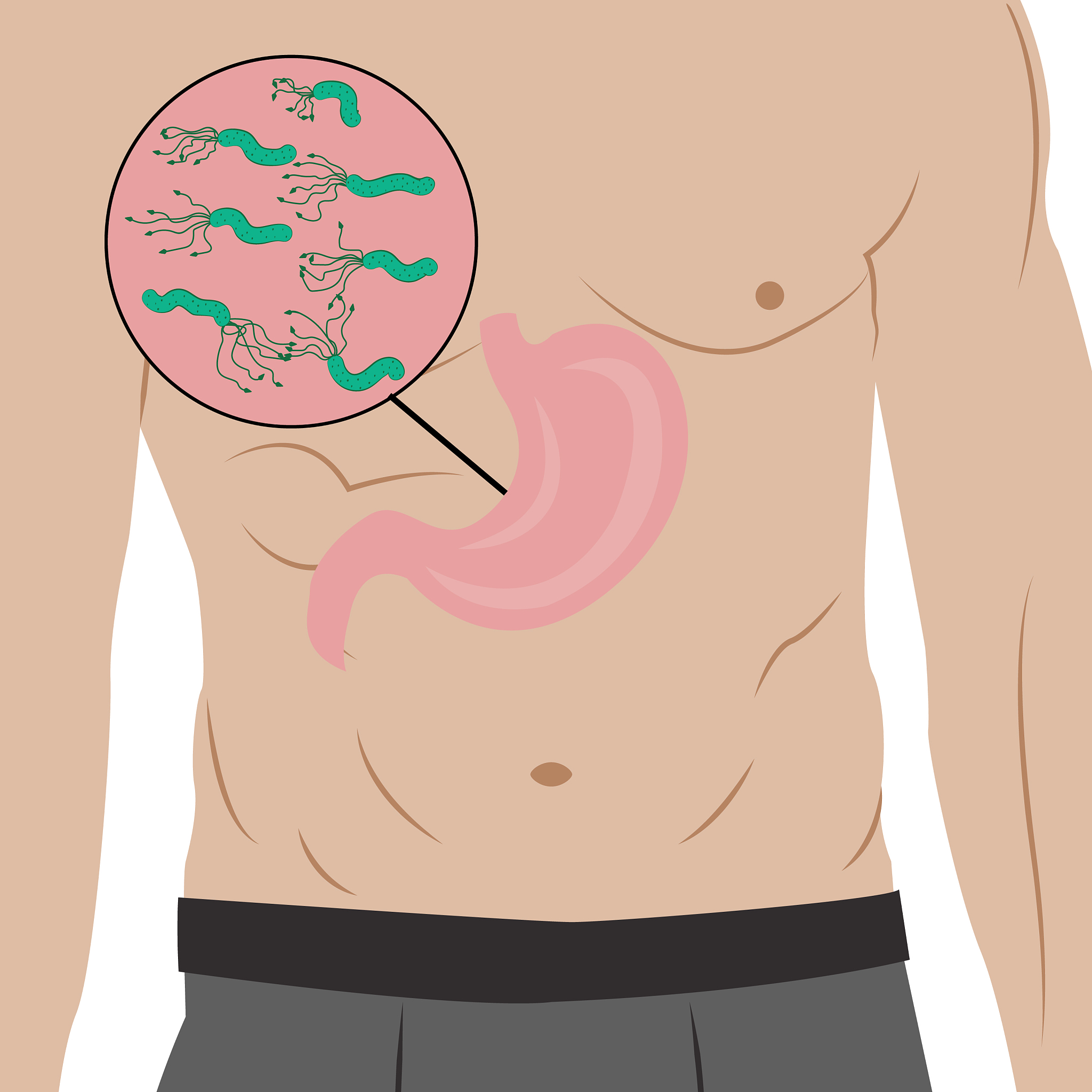 如果你是一位自媒体请优化创意如下标题爆款数量3个：幽门螺杆菌最全科普来了看完你就全懂了！不看就可惜了字数要求明显于30字