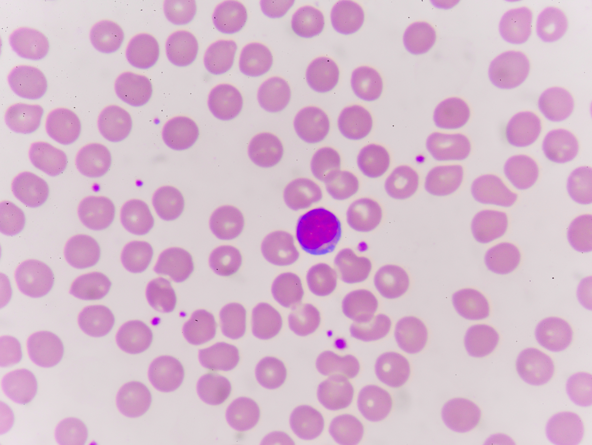 氧离曲线左右移动意义