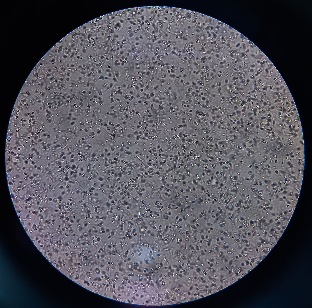 精液呈黄色果冻状怎么恢复