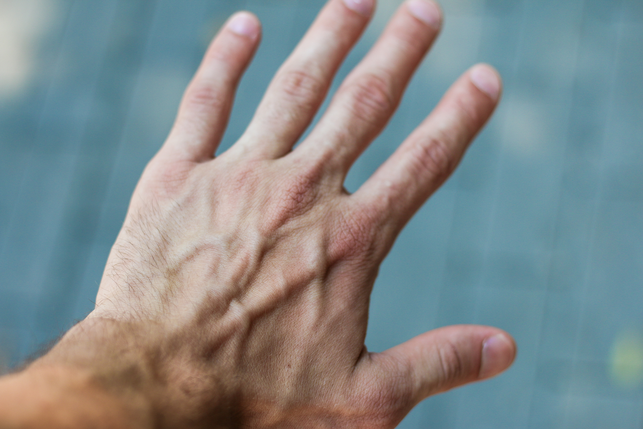 手掌受伤了会有哪些困扰