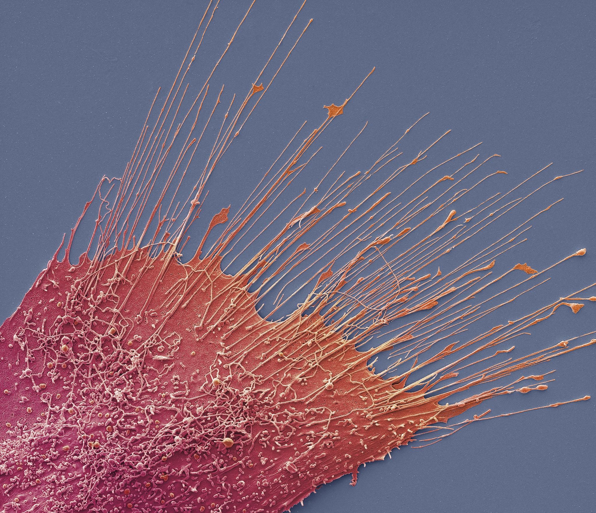 无磁电阻丝：特点、应用及优势