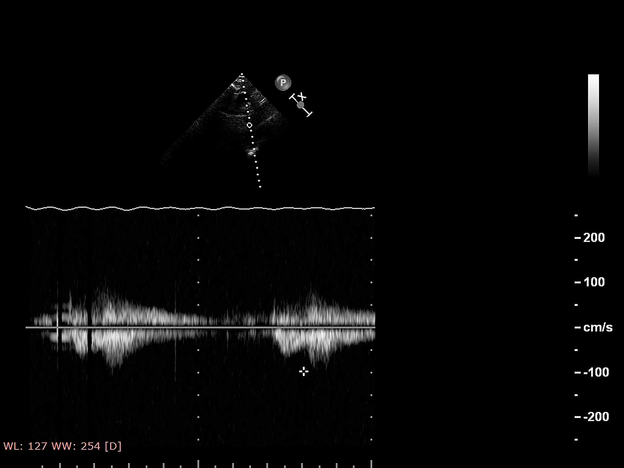 干涉现象：加强与减弱的原理及公式解析