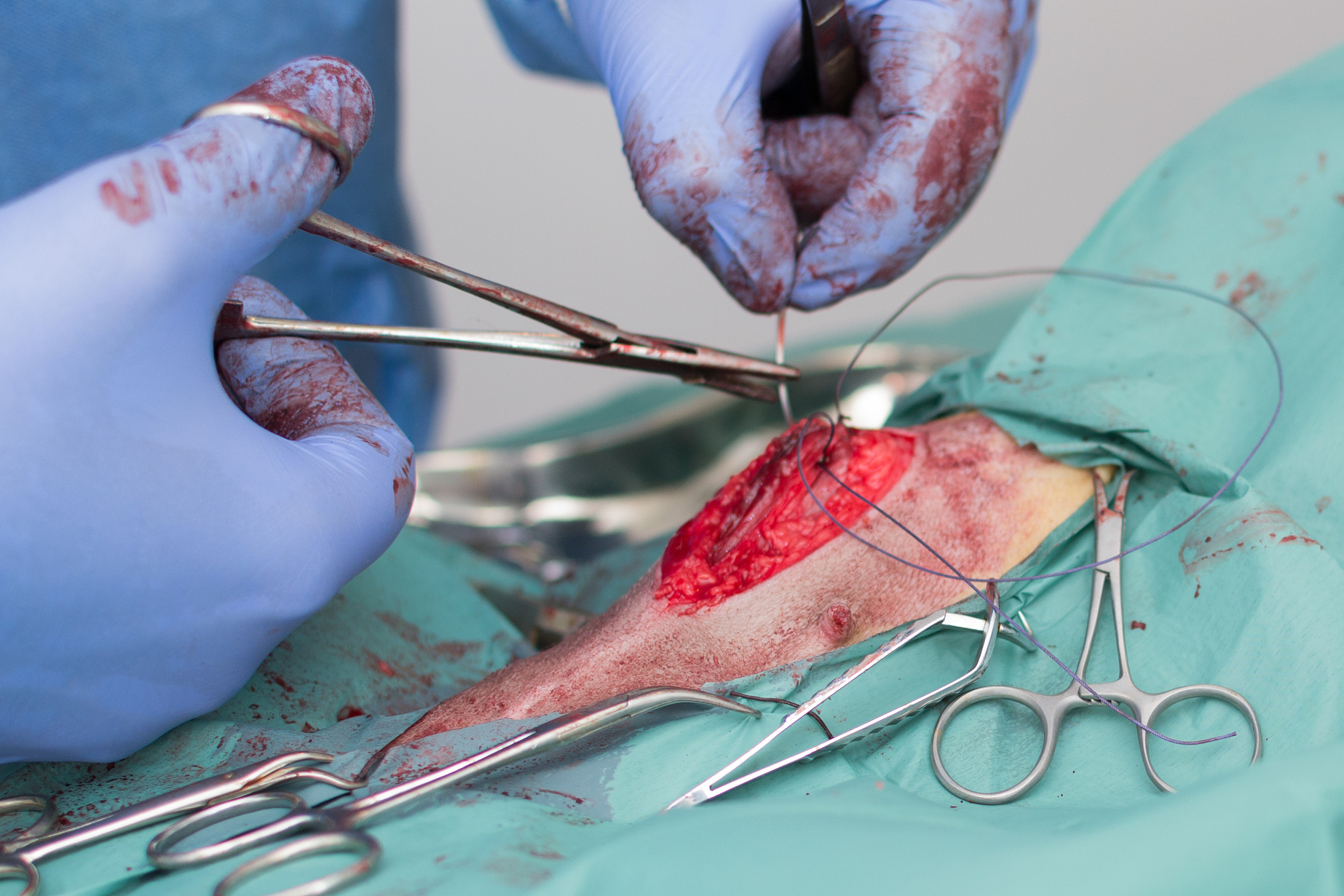 close-up of doctor performing operation on patient