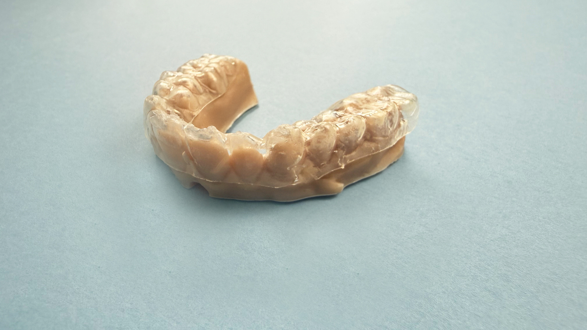 Braces 的含义 - 牙套、支架、托架 - 解释及应用