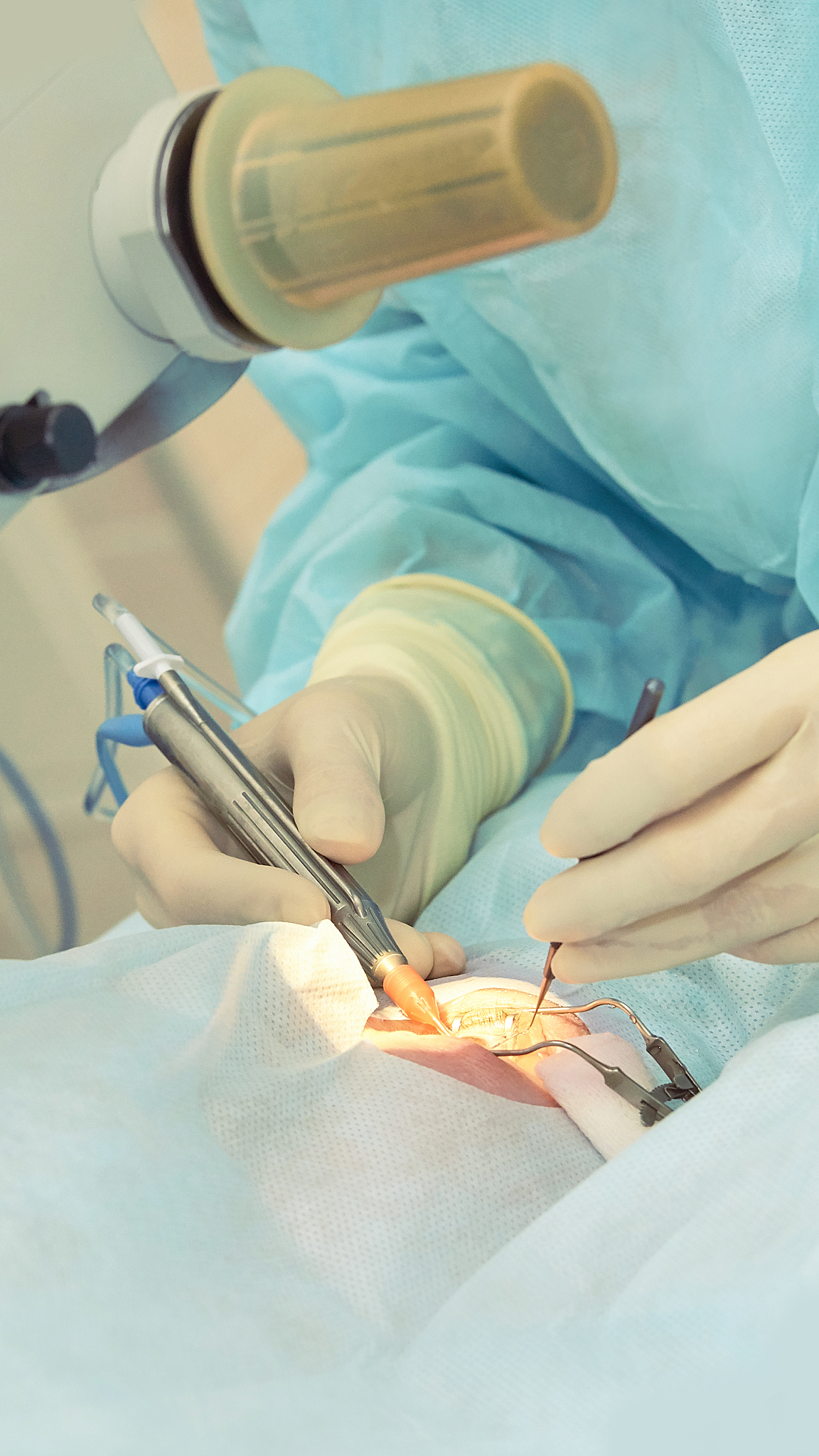 ophthalmology laser microscope operation. doctor in clinic. pati