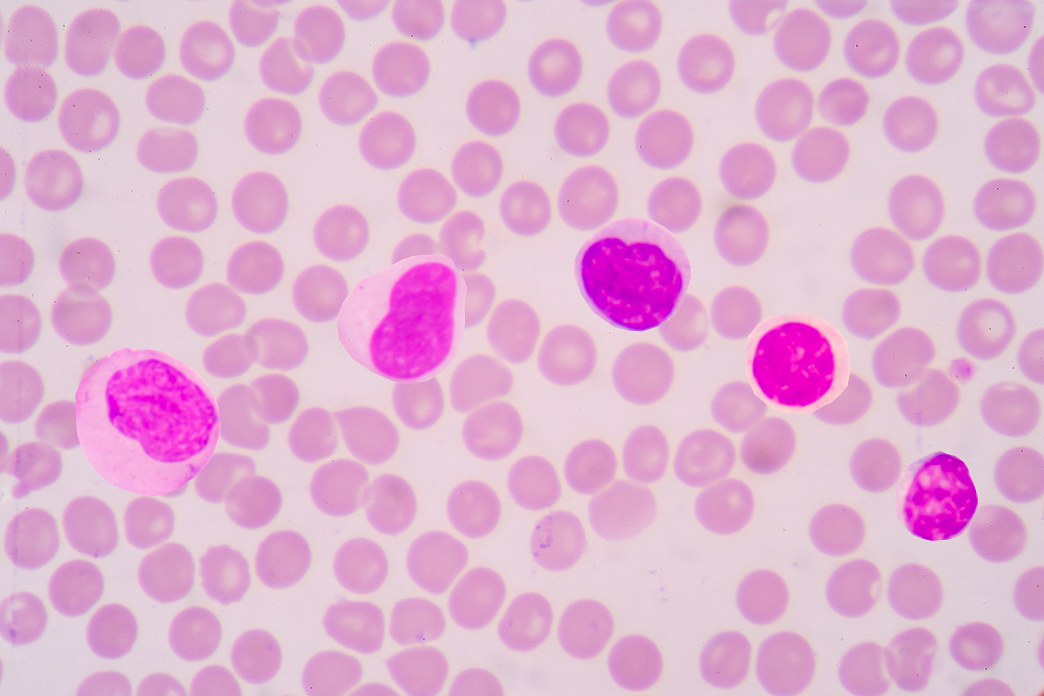 正常人体血液中白细胞比例:各类型占比差异及影响因素 正常人体血液中白细胞比例:各类型占比差异及影响因素