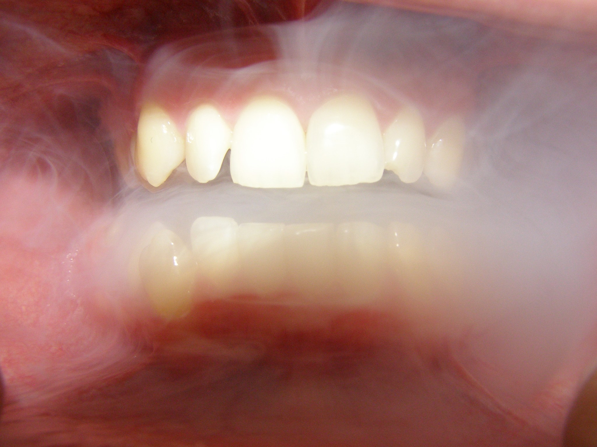 三峡联合职业大学口腔医学专业介绍：培养口腔医学人才，就业前景广阔