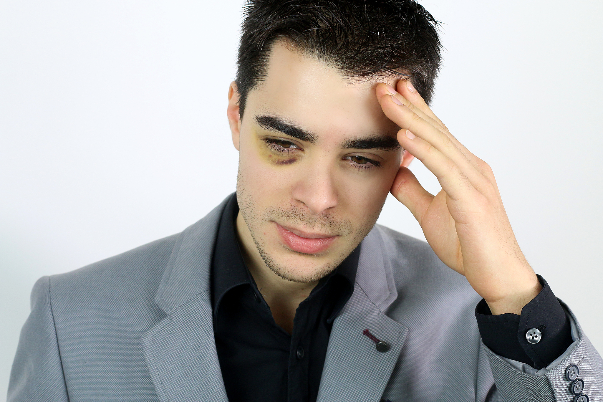 young businessman  who has been assaulted
