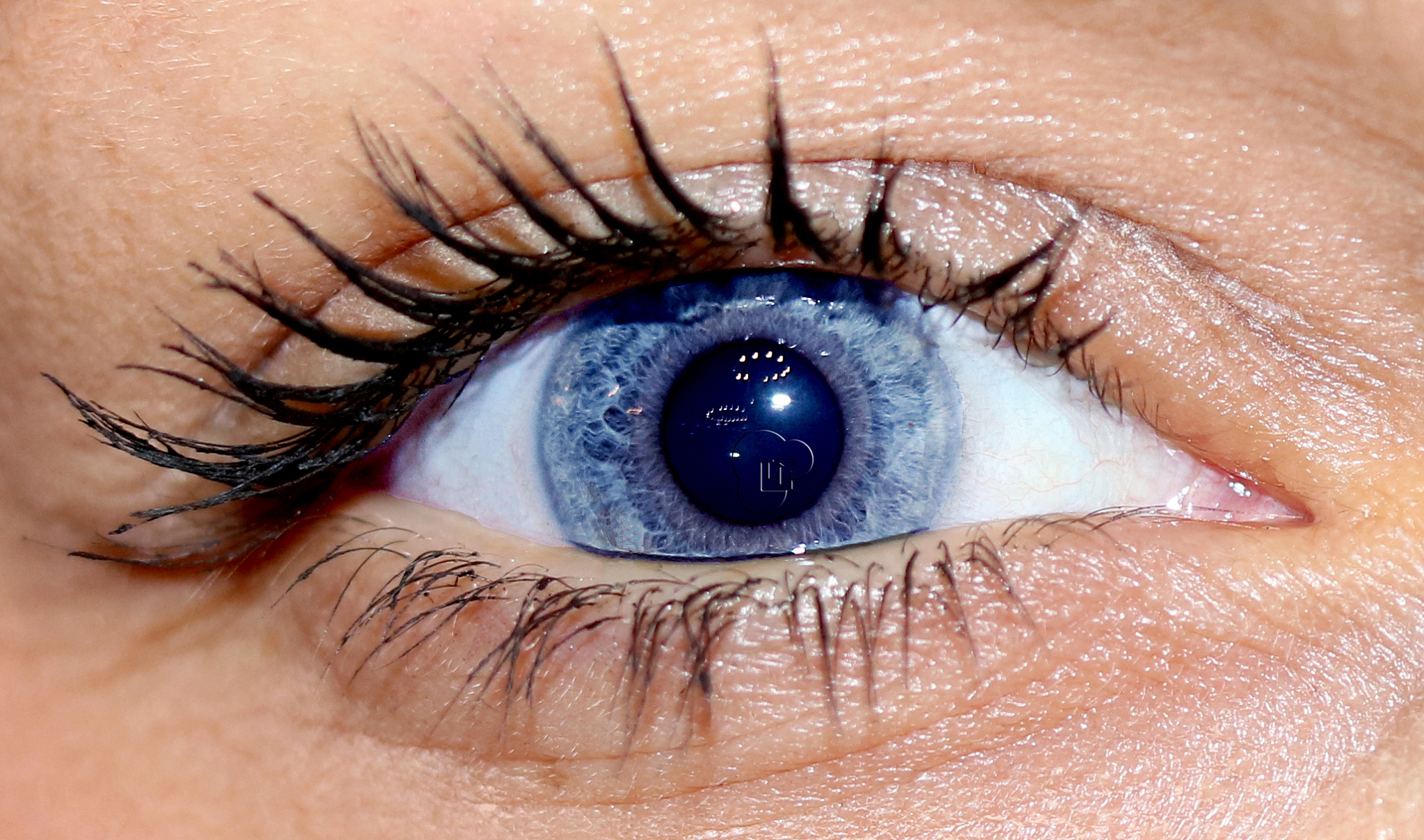 the eye