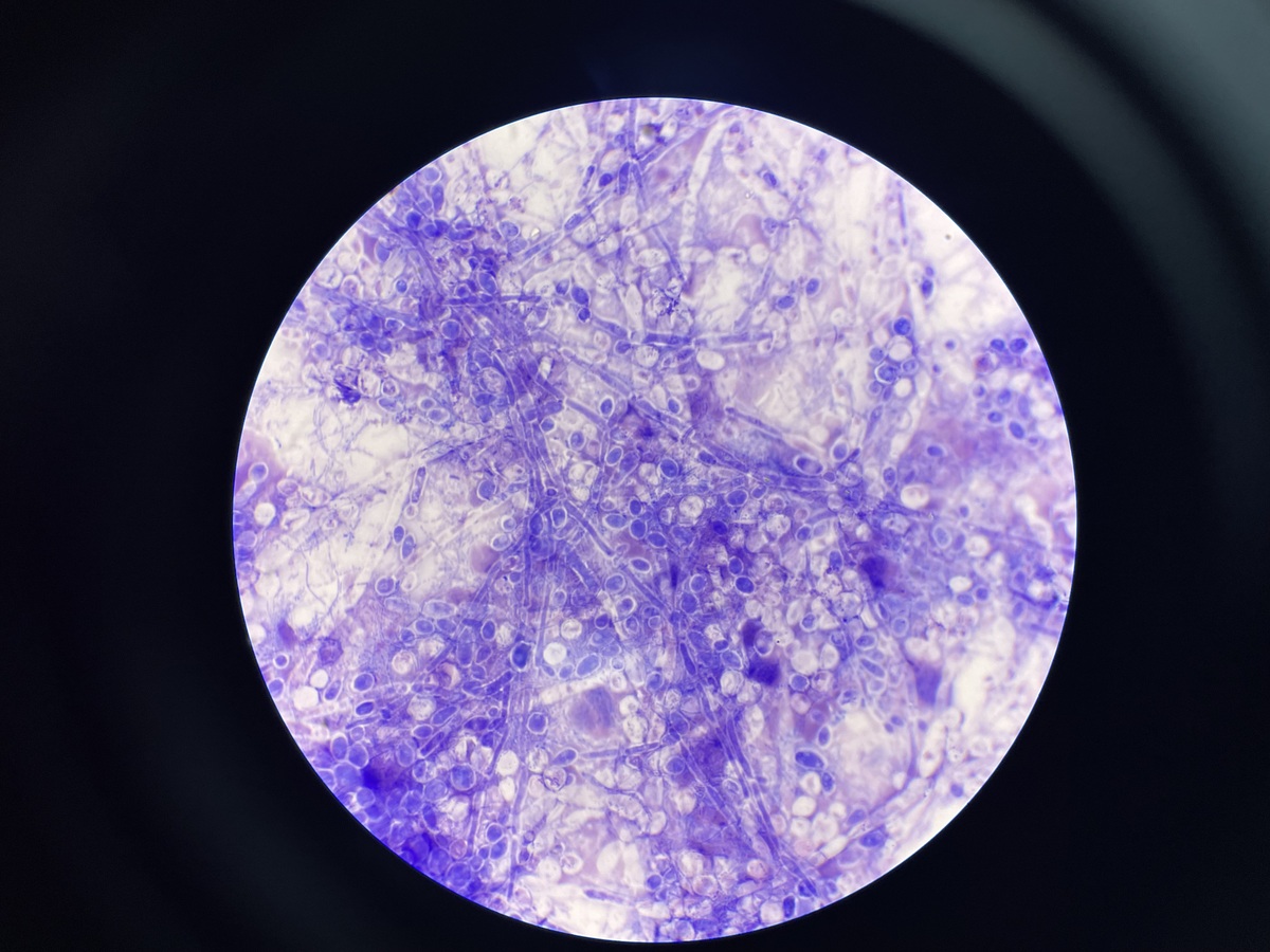 Isolation and Culture of Human Endometrial Stromal Cells (ESCs) and Endometrial Epithelial Organoids (EEOs)