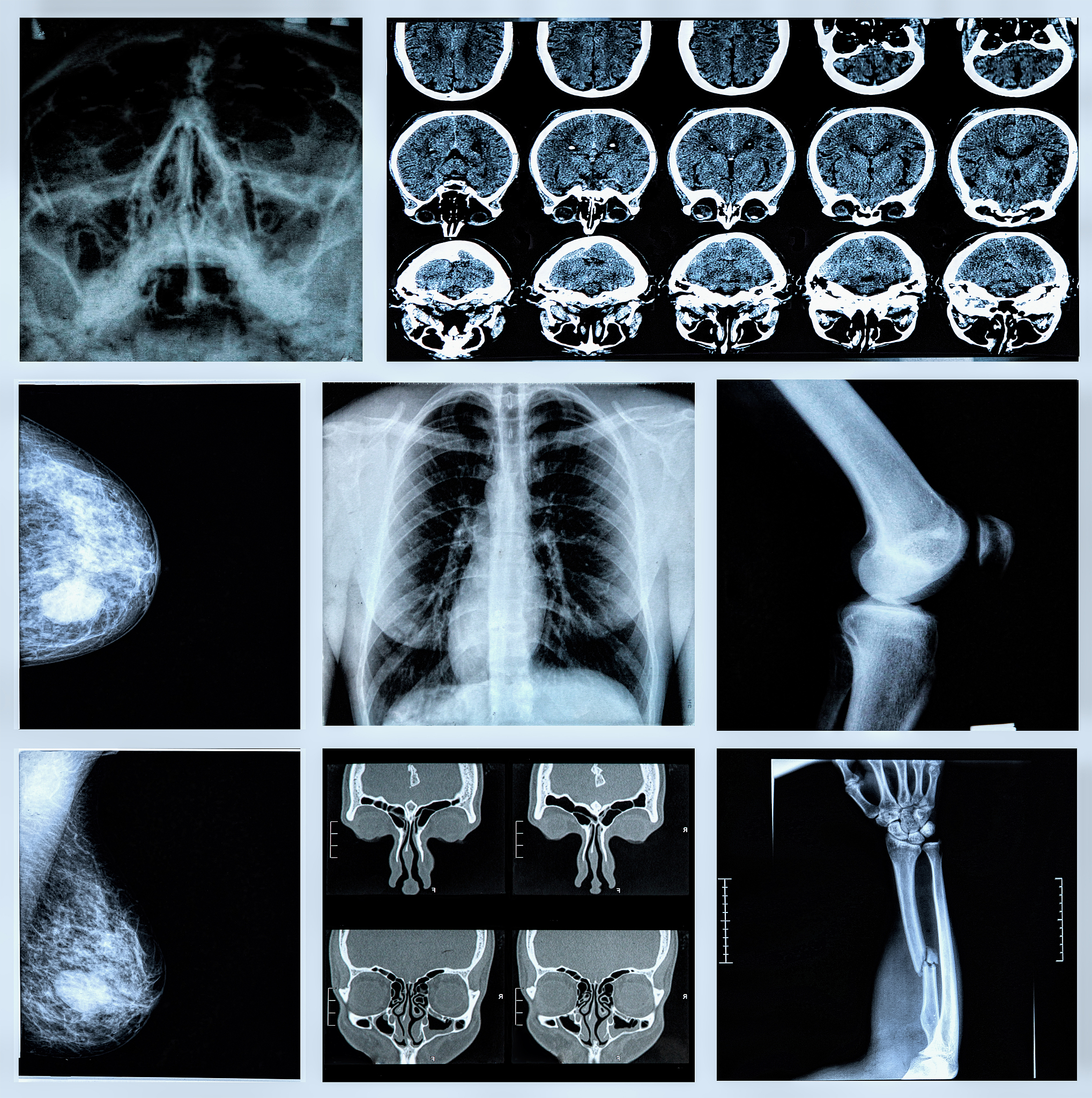 肿瘤复查都包括什么