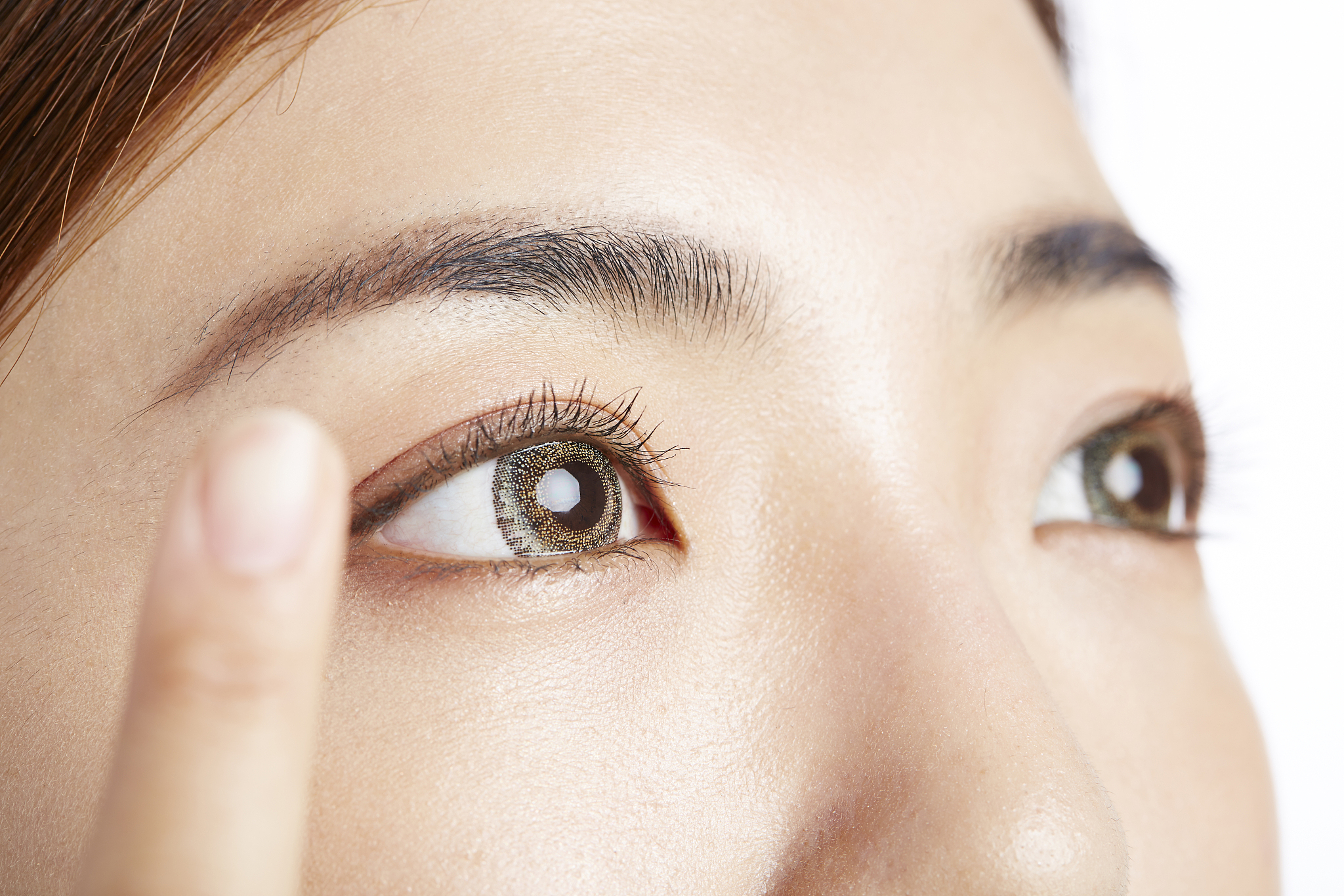 上眼皮褶皱多了怎么办？