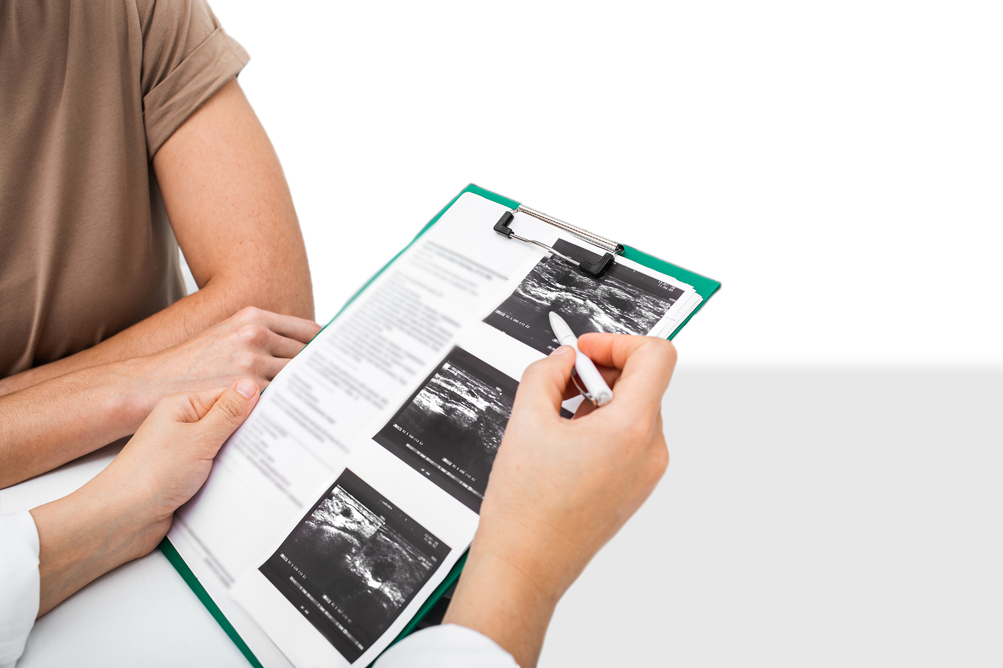 乳腺结节会病变吗