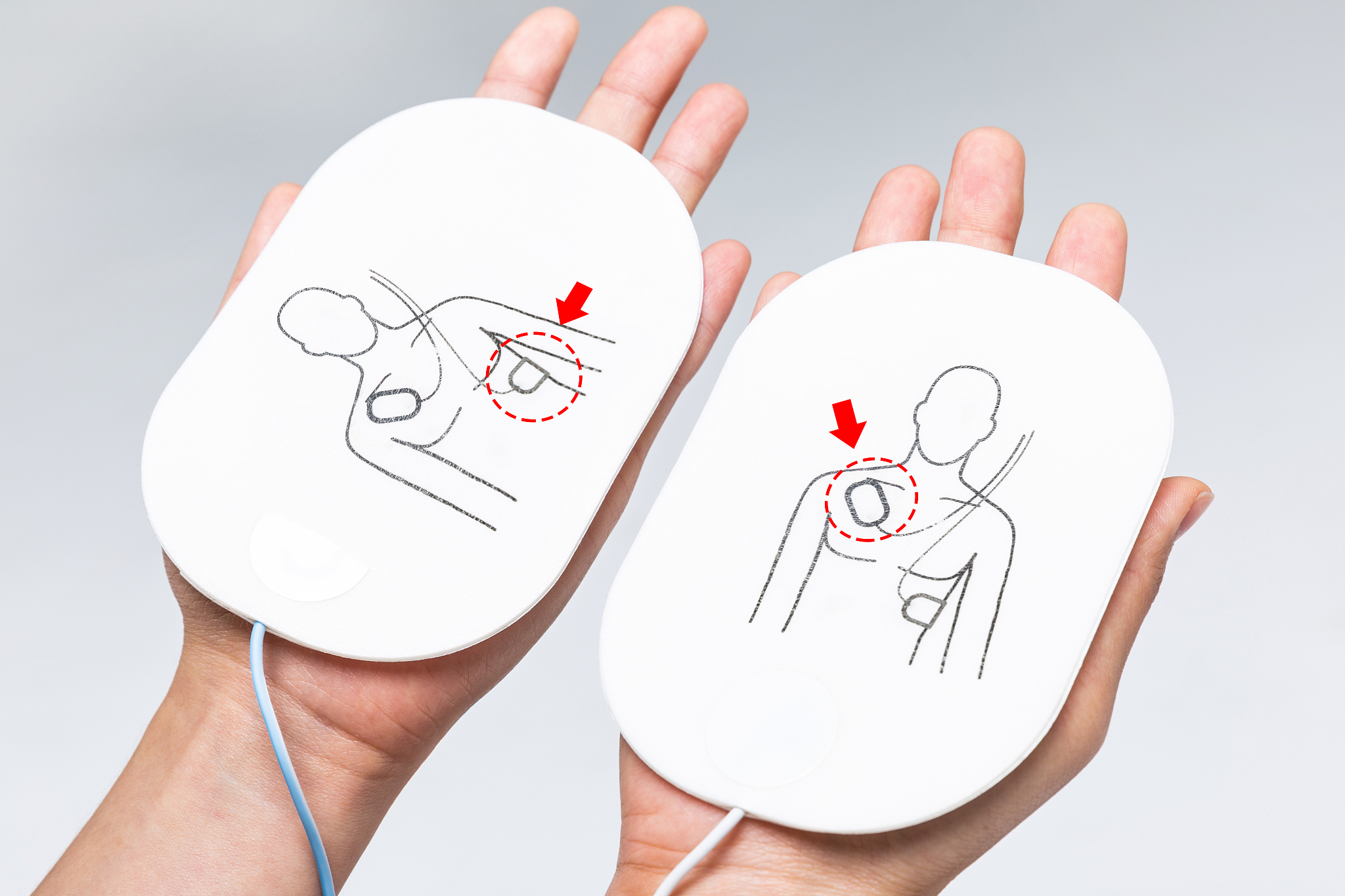 为什么不是先救火