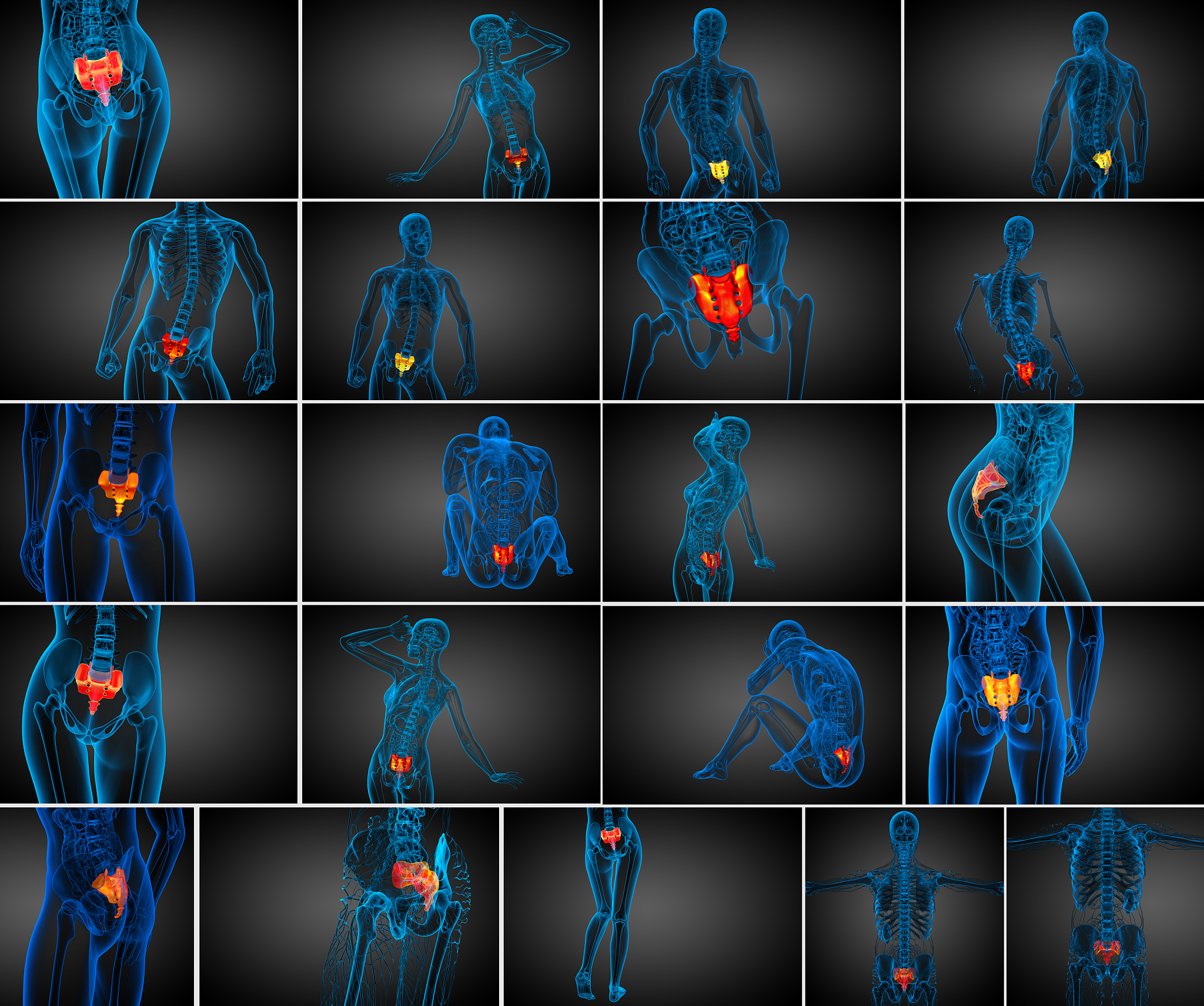 2D/3D 医学图像配准实验设计与评估