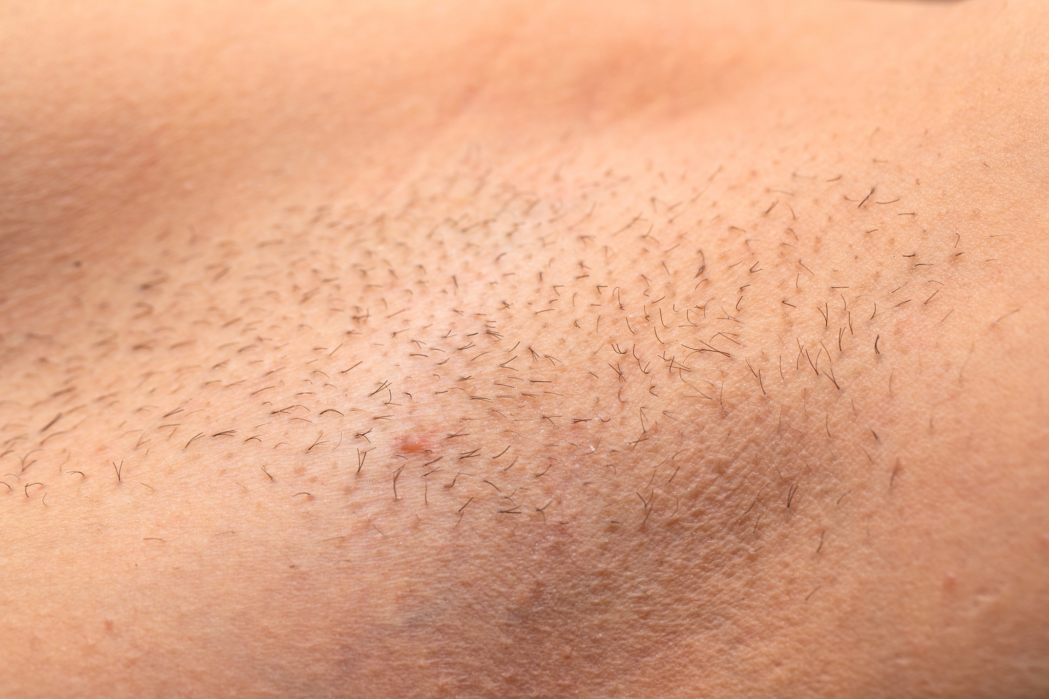 unshaved armpit close up