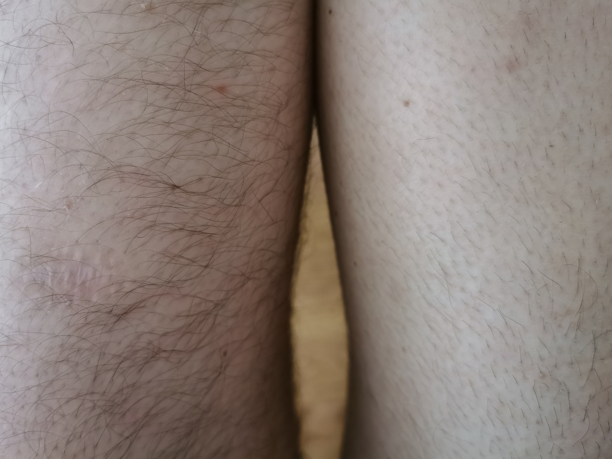 女生有腿毛代表了什么？