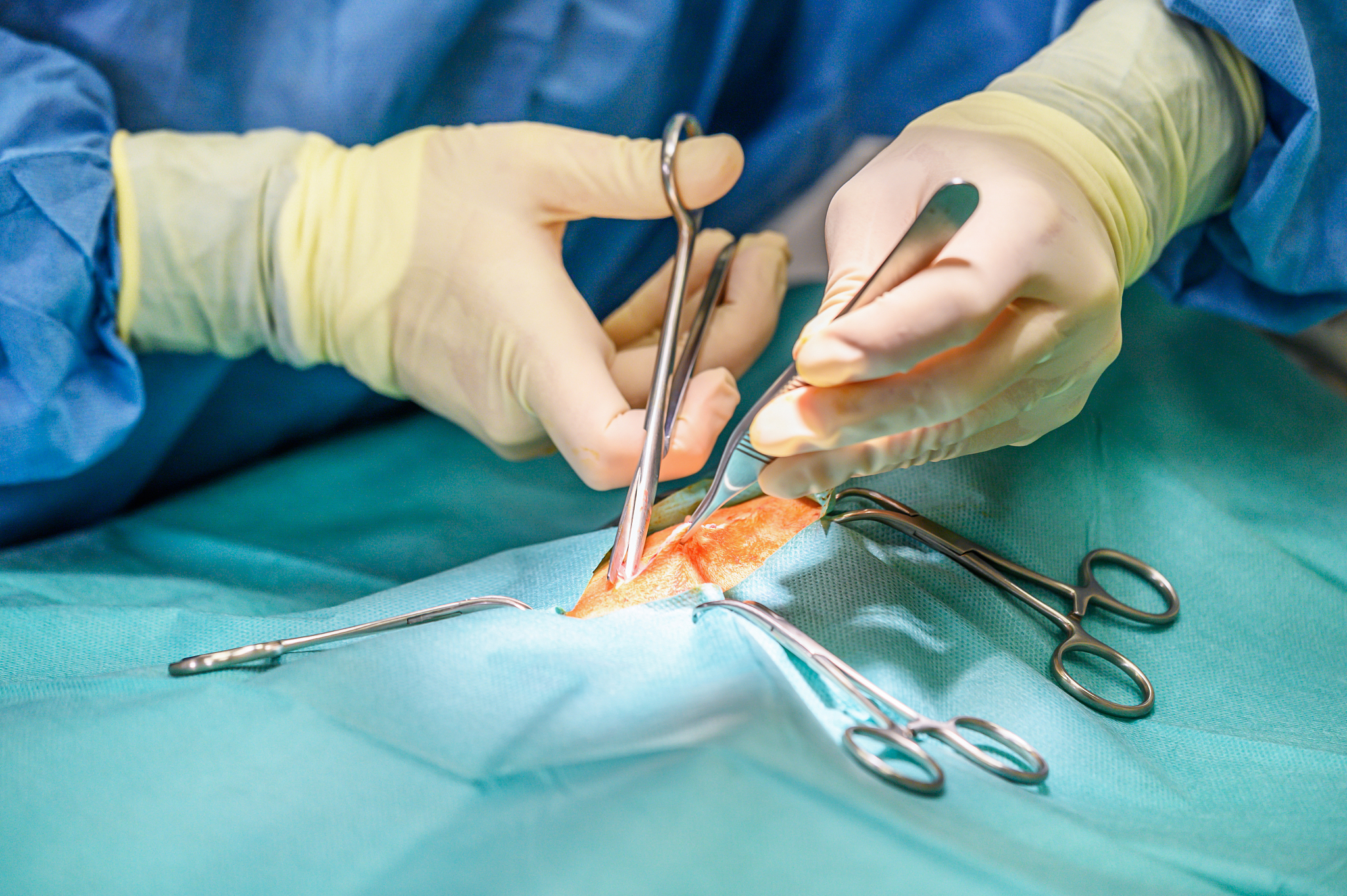 close-up, hands of the professional surgeon, doing surgery. in t