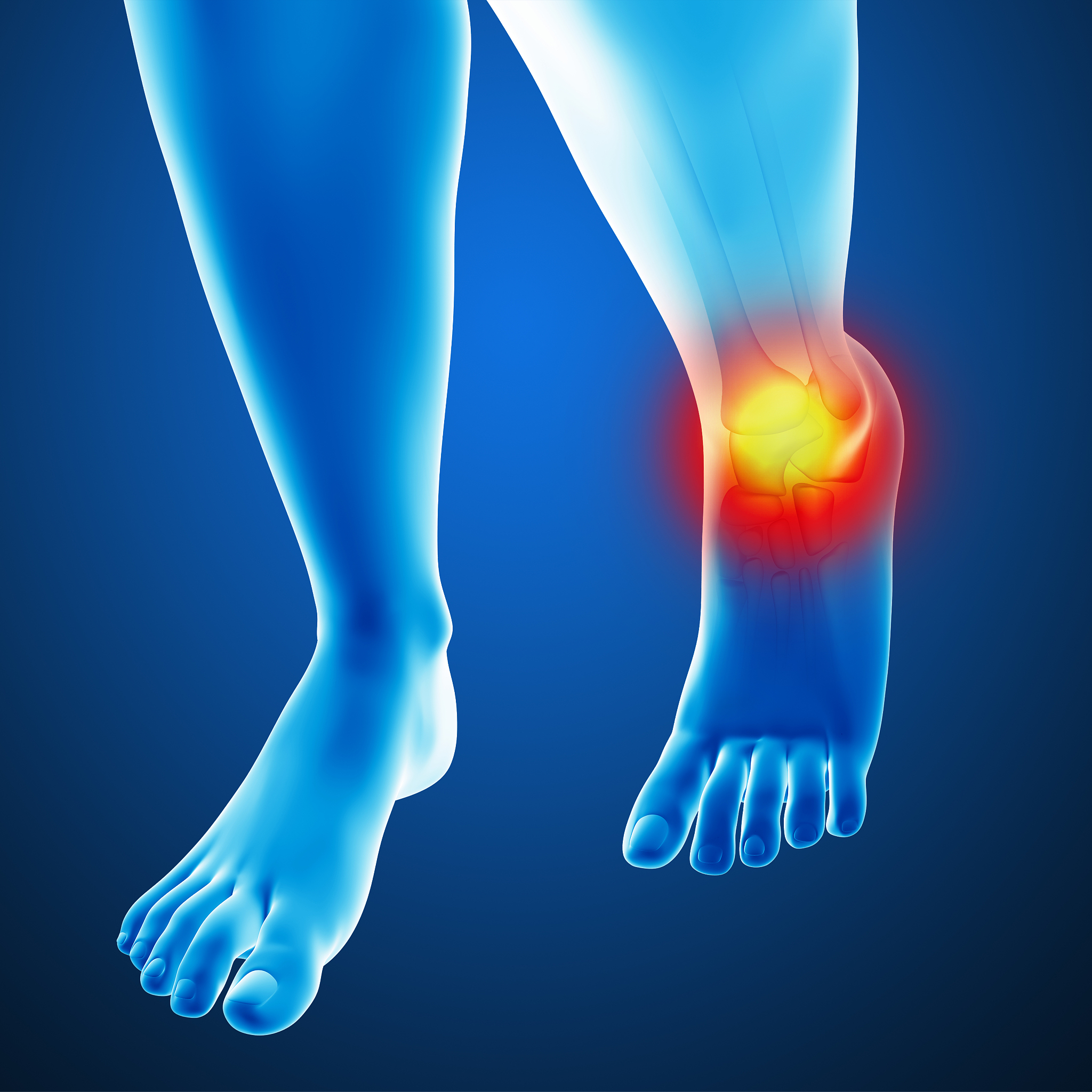 肺炎合并关节炎，关节护理刻不容缓！