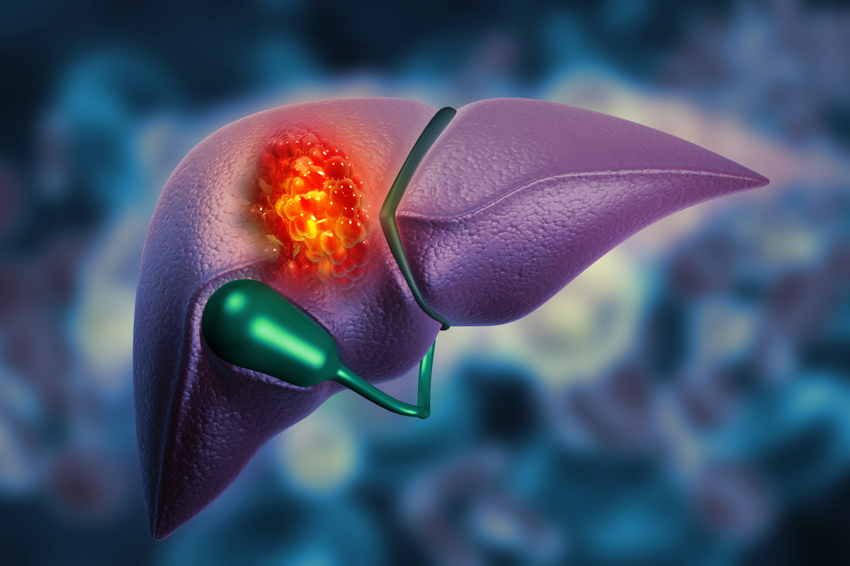 慢性乙型肝炎肝纤维化