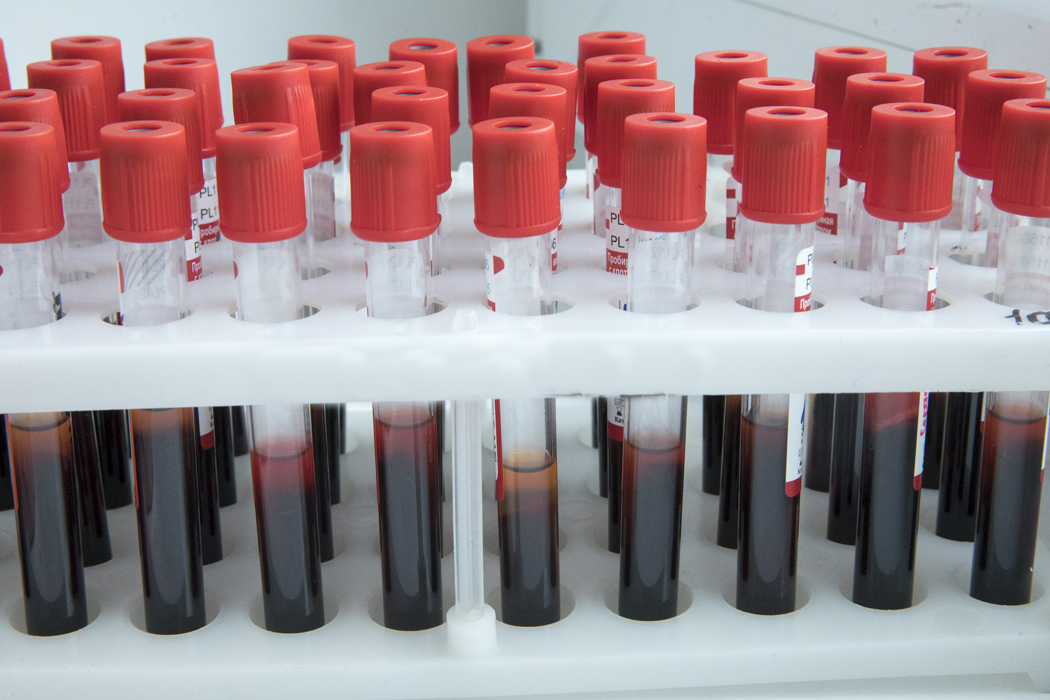 恩施州卫生学校医学检验技术 专业好不好？